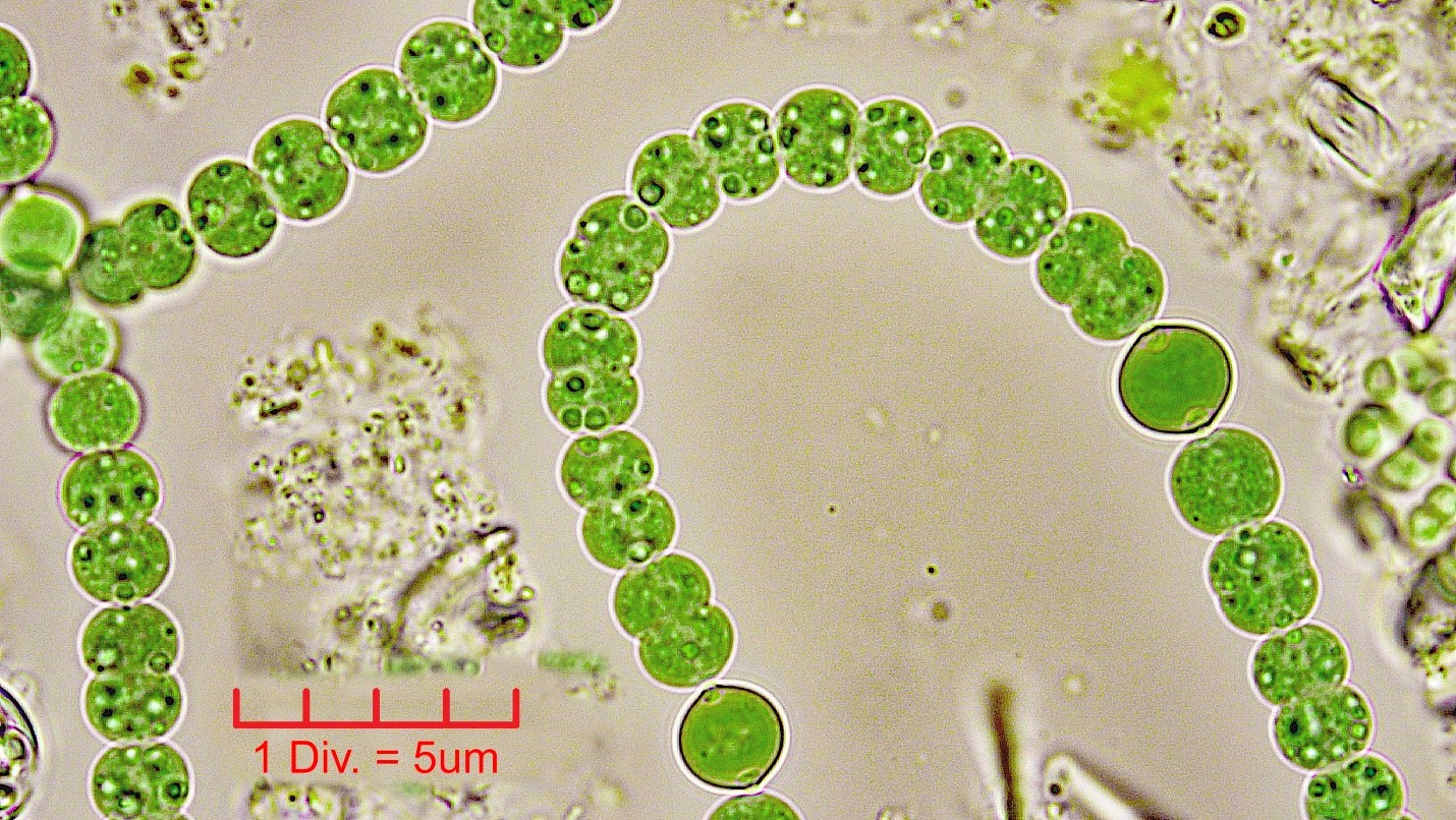 ././Cyanobacteria/Nostocales/Aphanizomenonaceae/Dolichospermum/sp/dolichospermum-552.jpg