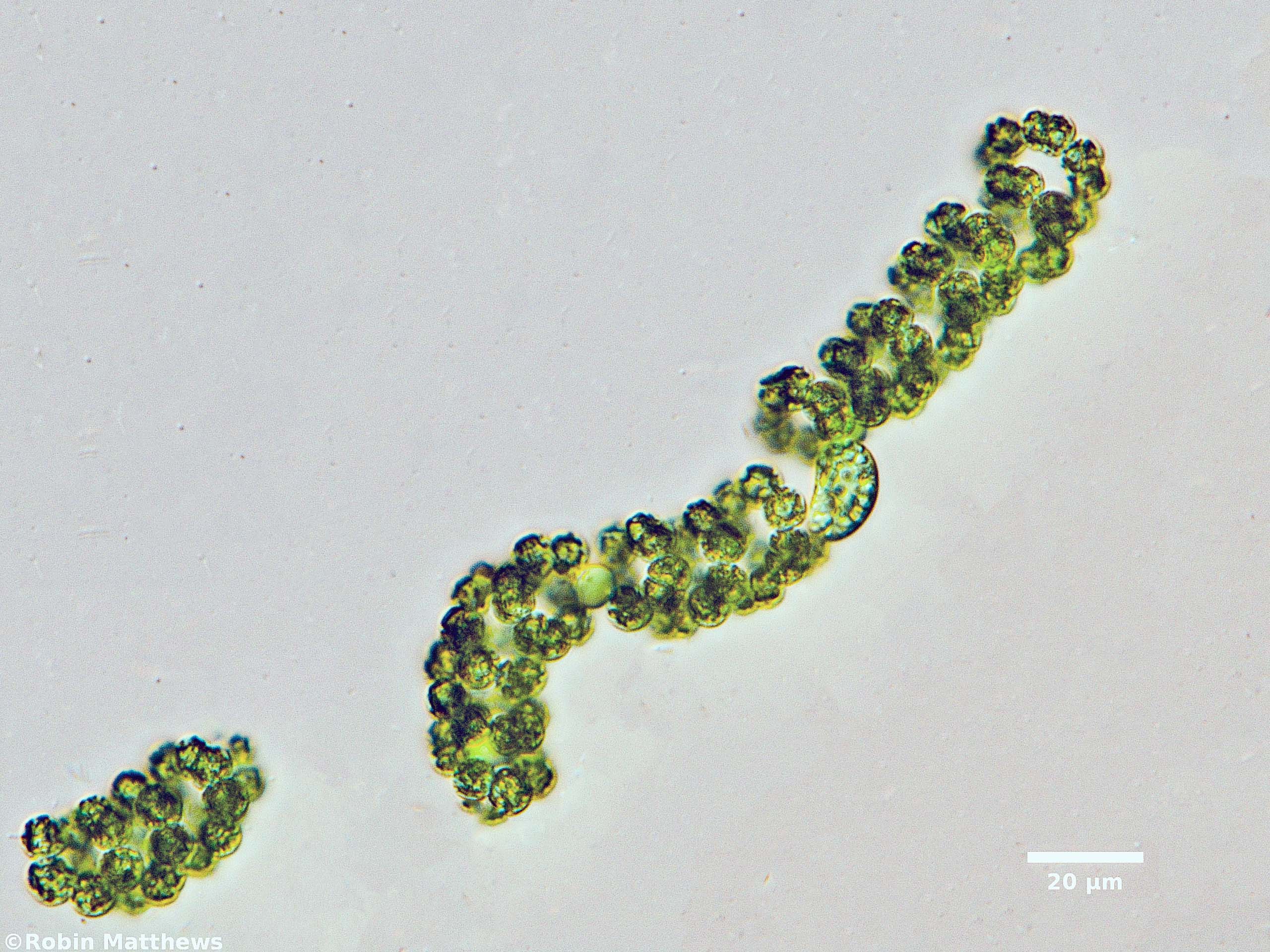 Cyanobacteria/Nostocales/Aphanizomenonaceae/Dolichospermum/spiroides/dolichospermum-580.jpg