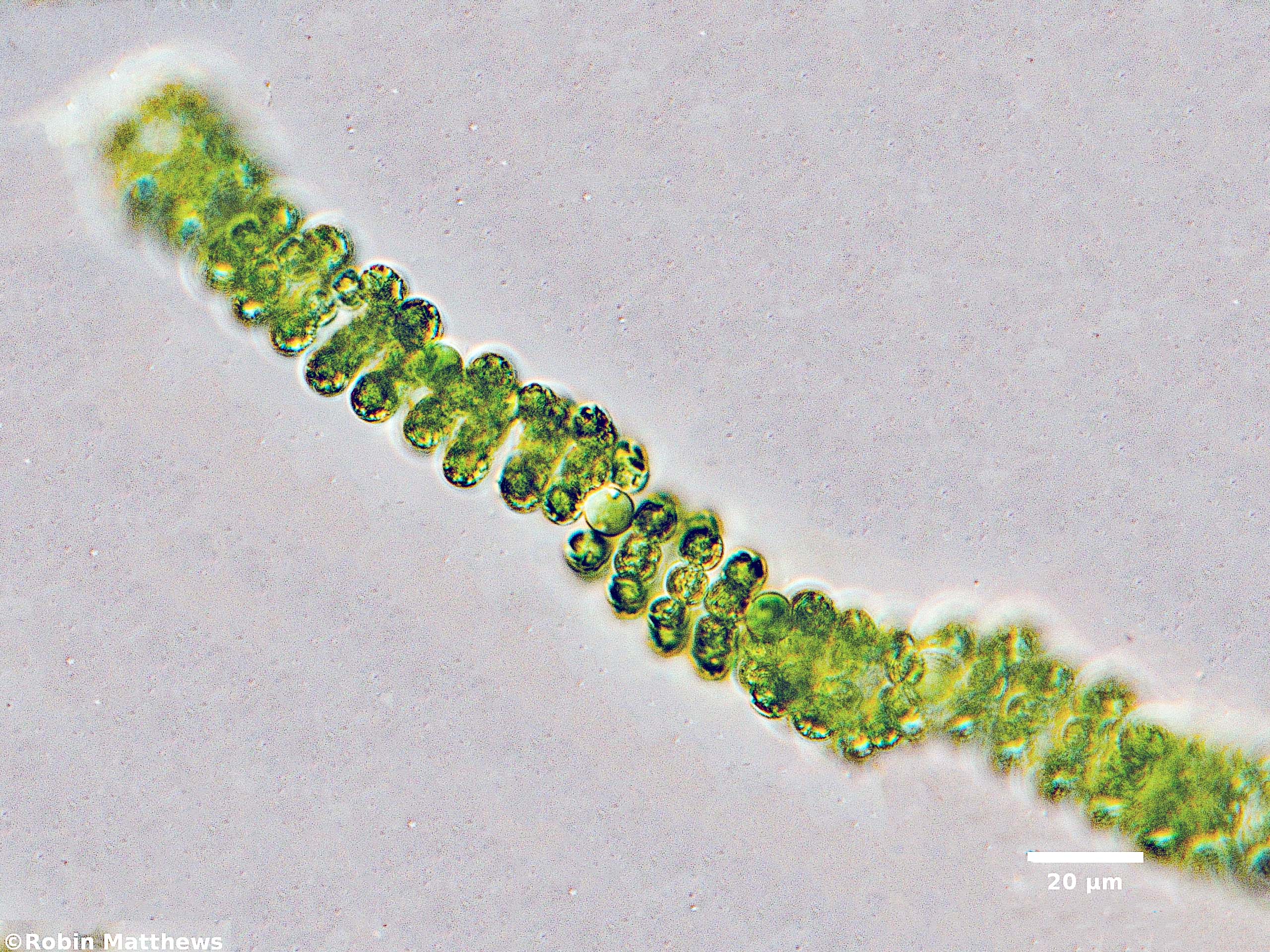 Cyanobacteria/Nostocales/Aphanizomenonaceae/Dolichospermum/spiroides/dolichospermum-581.jpg