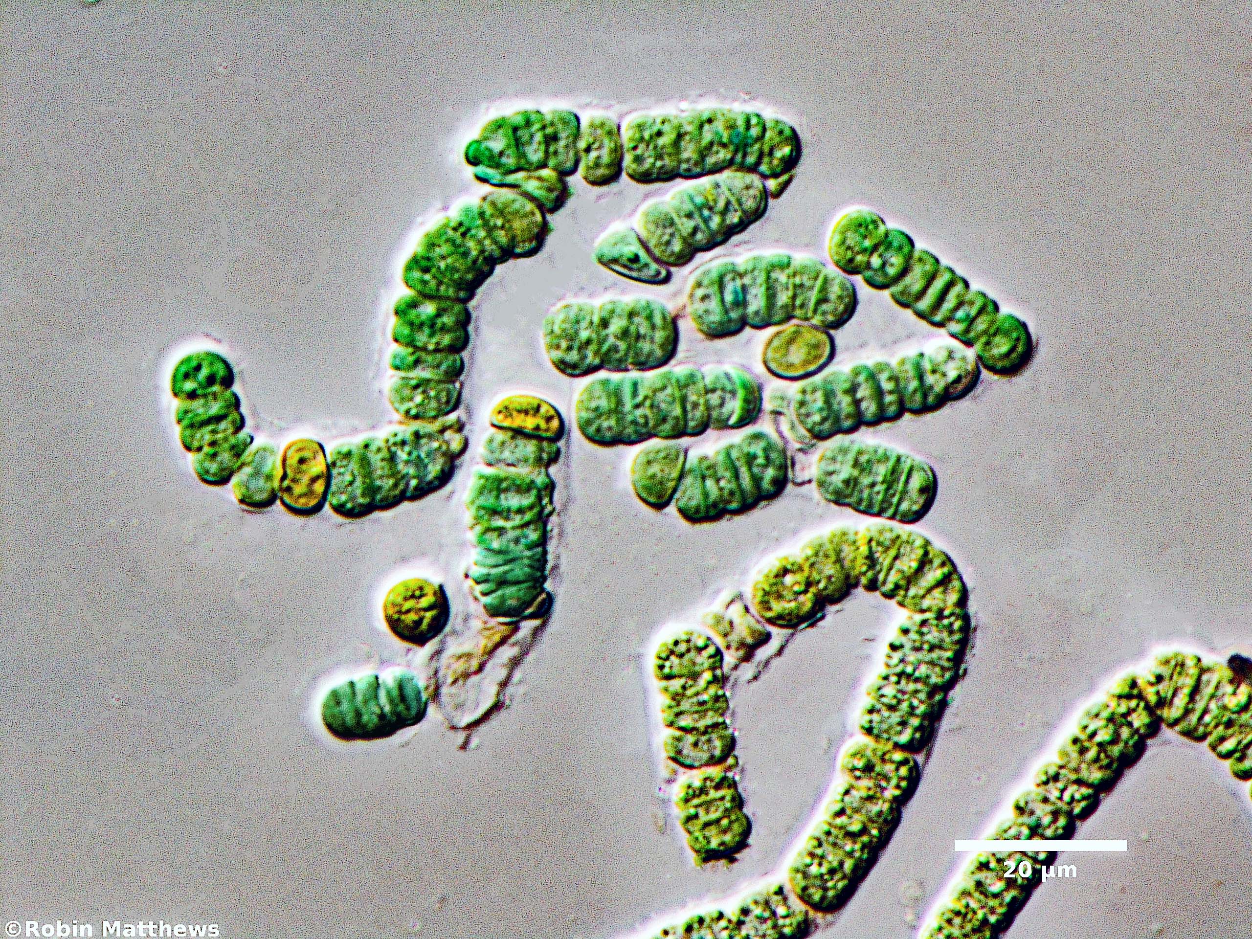 Cyanobacteria/Nostocales/Aphanizomenonaceae/Nodularia/sp/nodularia-586.jpg