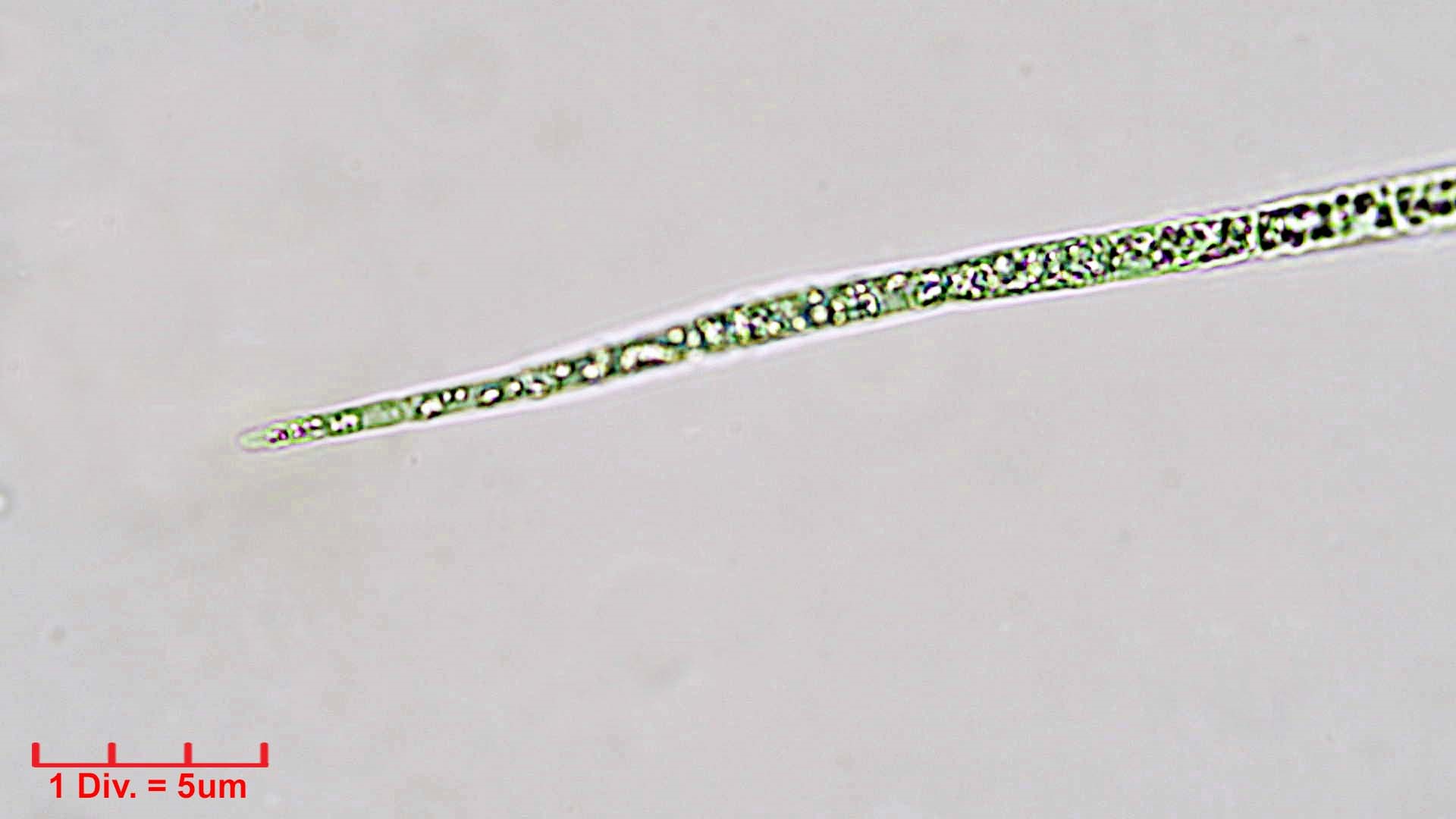 ./Cyanobacteria/Nostocales/Aphanizomenonaceae/Raphidiopsis/sp/raphidiopsis-549.jpg