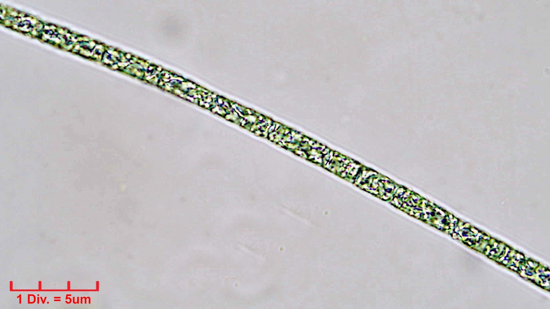 Cyanobacteria/Nostocales/Aphanizomenonaceae/Raphidiopsis/sp/raphidiopsis-550.jpg