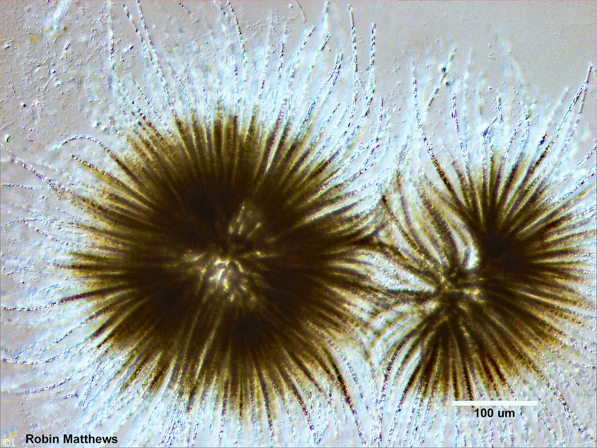 Cyanobacteria/Nostocales/Gloeotrichiaceae/Gloeotrichia/echinulata/gloeotrichia-echinulata-492.jpg