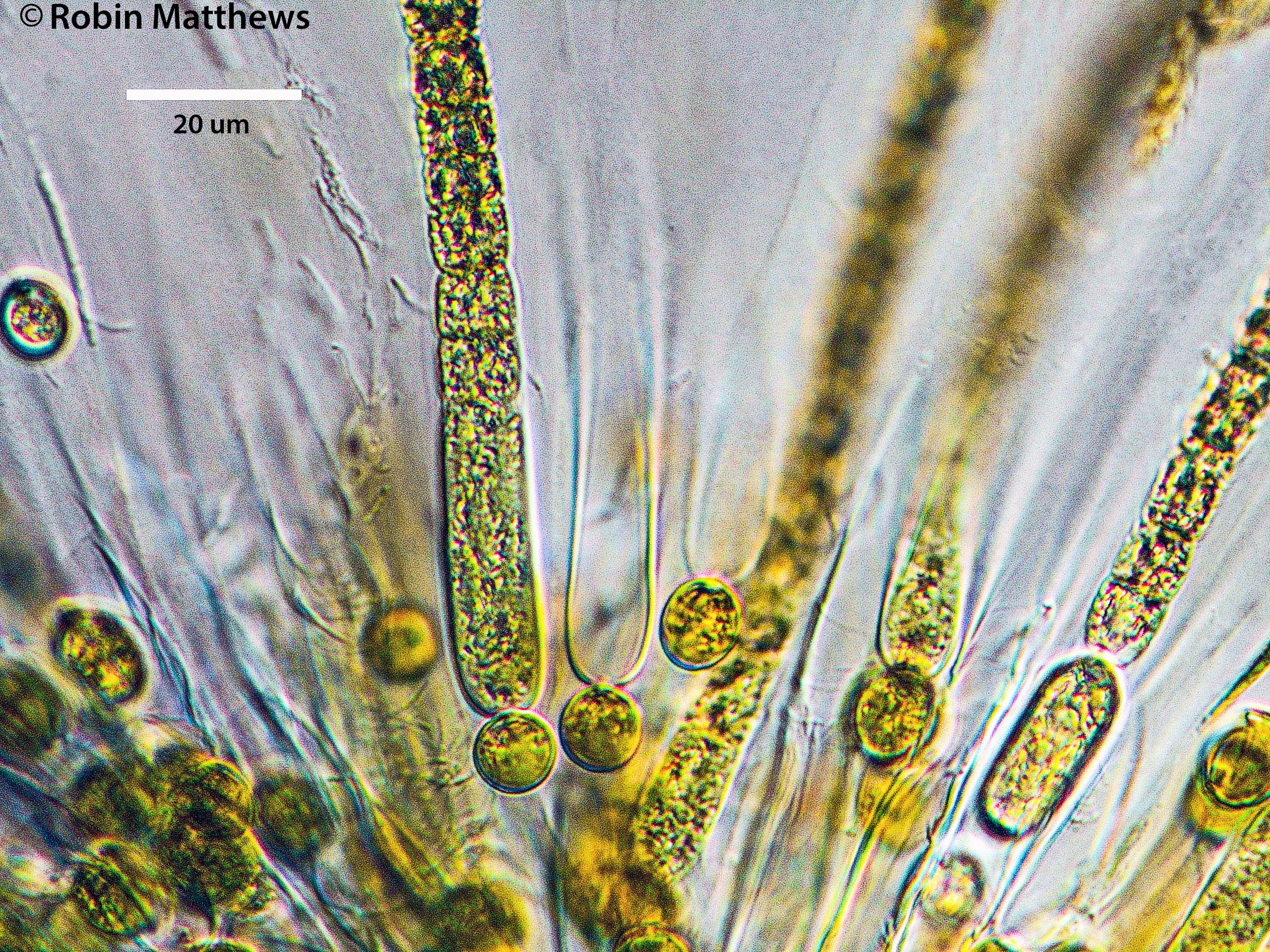 Cyanobacteria/Nostocales/Gloeotrichiaceae/Gloeotrichia/echinulata/gloeotrichia-echinulata-496.jpg
