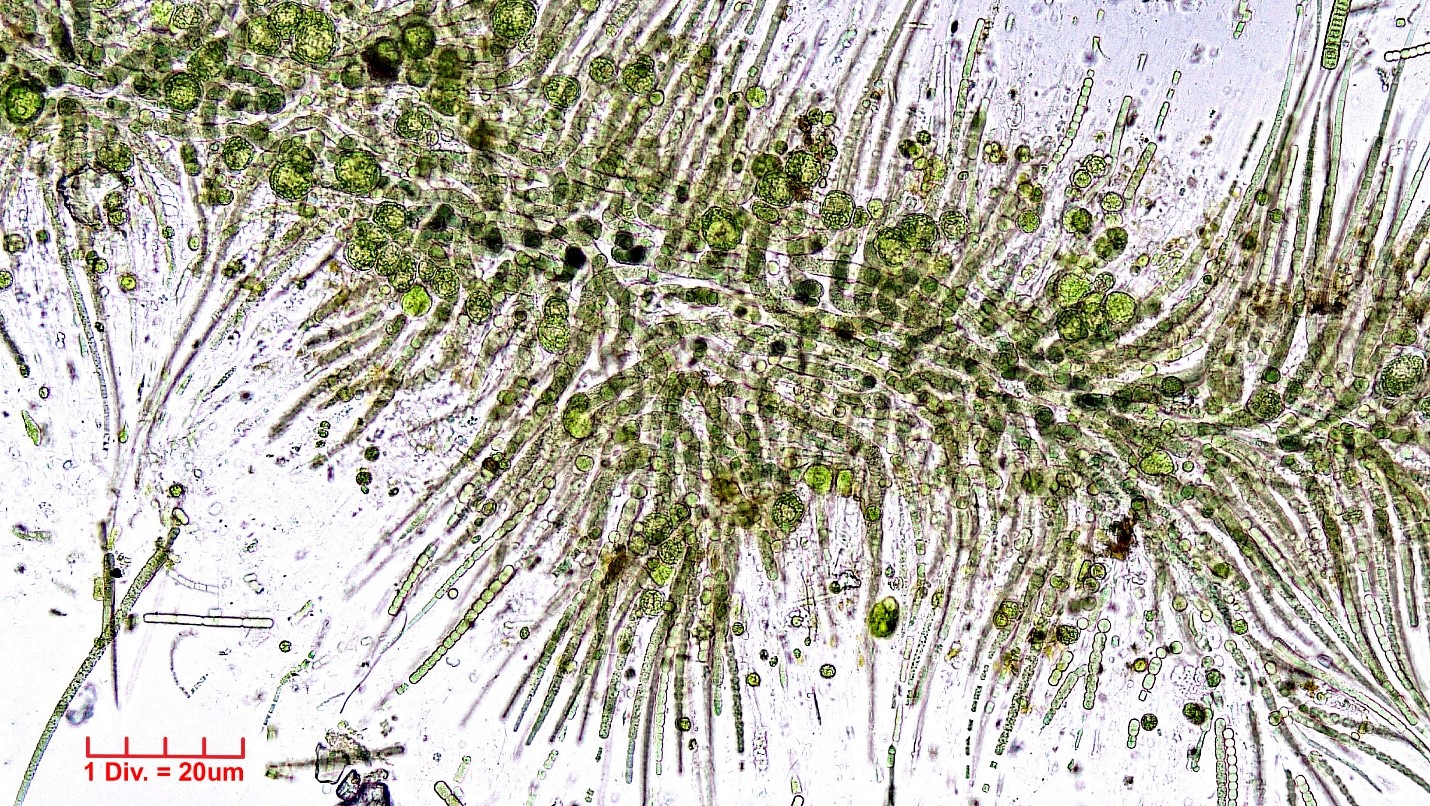 Cyanobacteria/Nostocales/Gloeotrichiaceae/Gloeotrichia/natans/gloeotrichia-natans-482.jpg