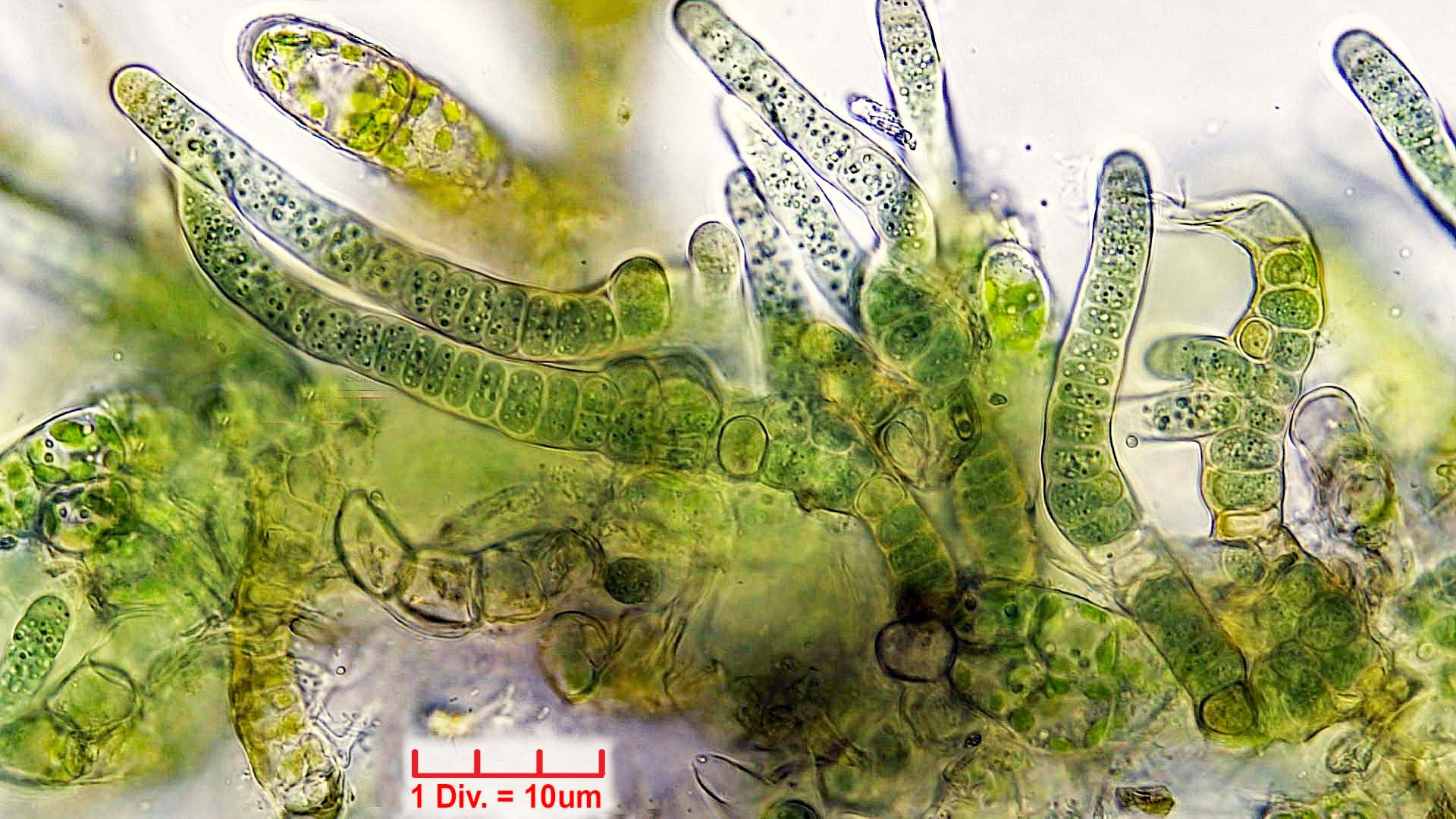 Cyanobacteria/Nostocales/Hapalosiphonaceae/Fischerella/muscicola/fischerella-muscicola-510.jpg