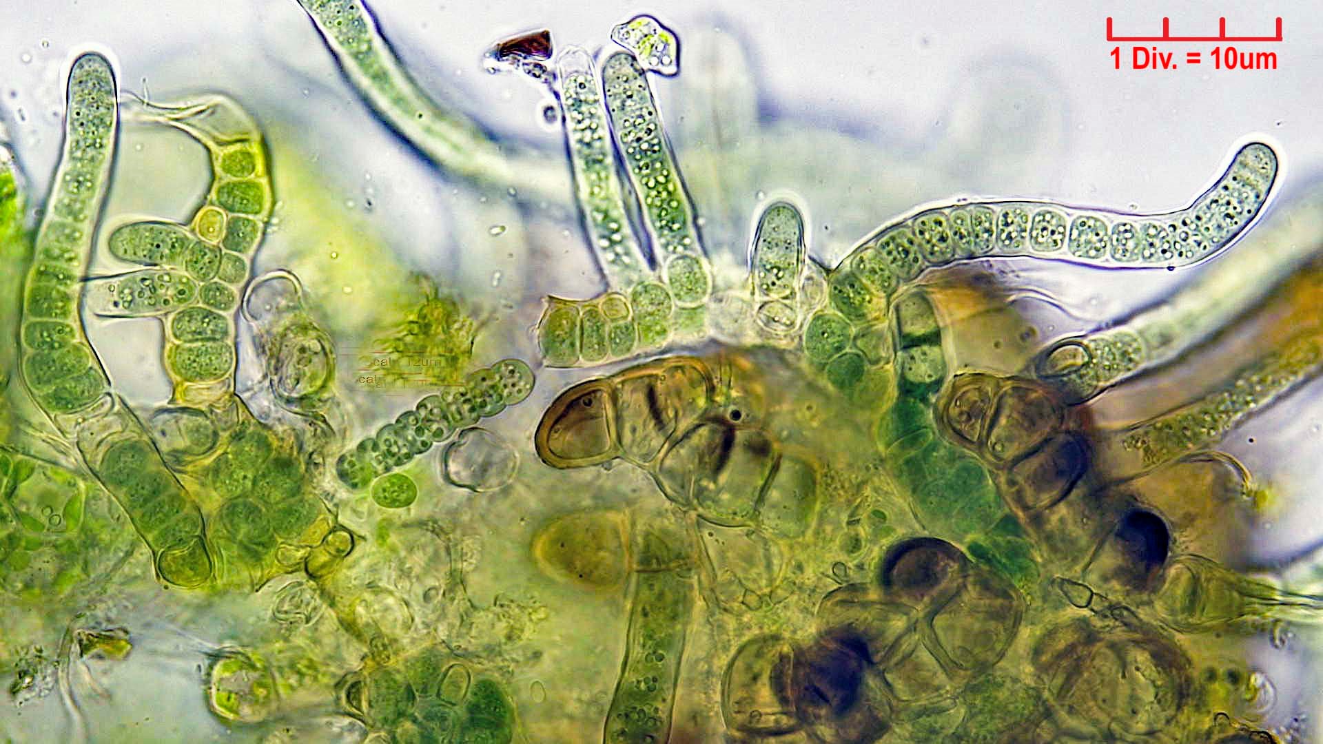 ././Cyanobacteria/Nostocales/Hapalosiphonaceae/Fischerella/muscicola/fischerella-muscicola-511.jpg