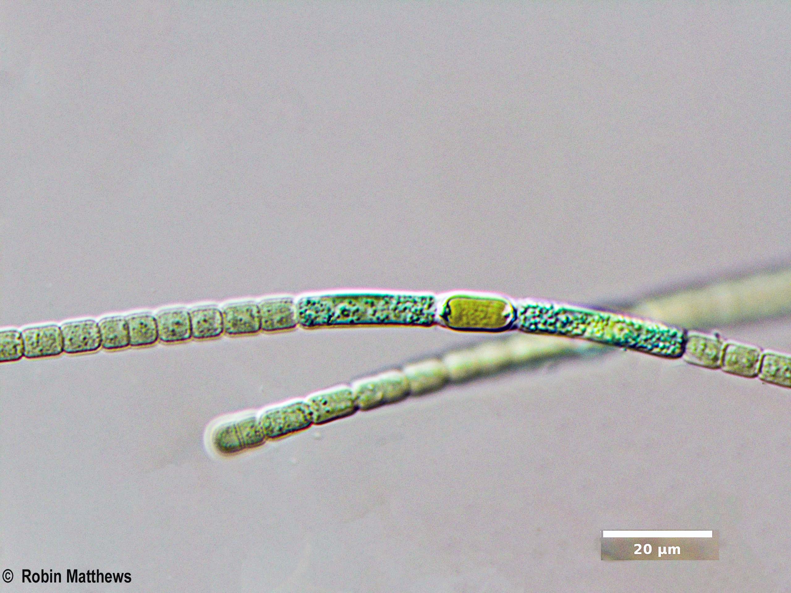 ./Cyanobacteria/Nostocales/Nostocaceae/Anabaena/cylindrica/anabaena-cylindrica-619.jpg