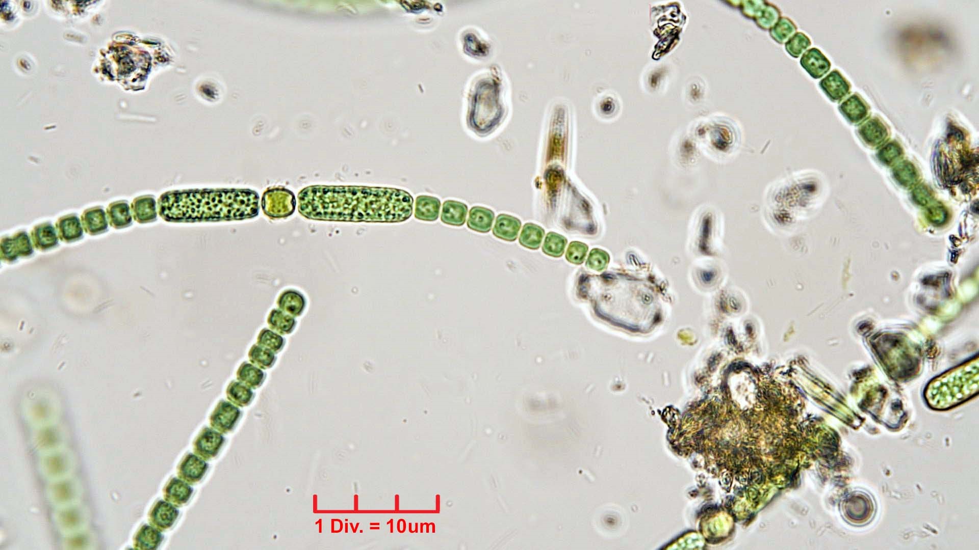 ./Cyanobacteria/Nostocales/Nostocaceae/Anabaena/oscillarioides/anabaena-oscillarioides-624.jpg