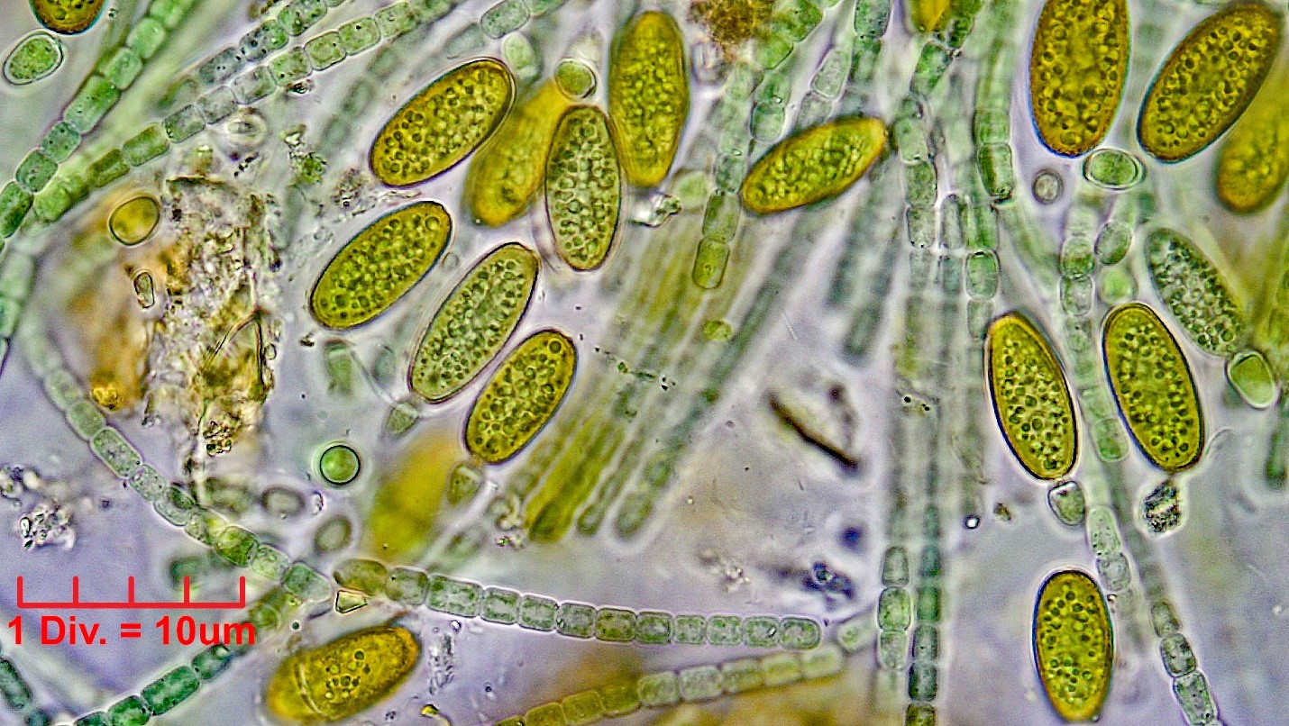 ./Cyanobacteria/Nostocales/Nostocaceae/Cylindrospermum/stagnale/cylindrospermum-stagnale-633.jpg