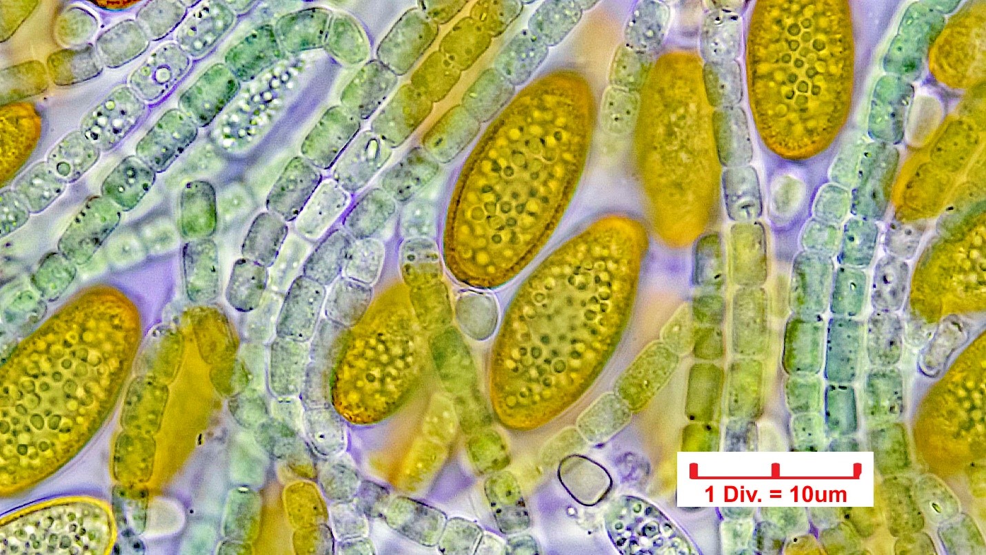 Cyanobacteria/Nostocales/Nostocaceae/Cylindrospermum/stagnale/cylindrospermum-stagnale-634.jpg