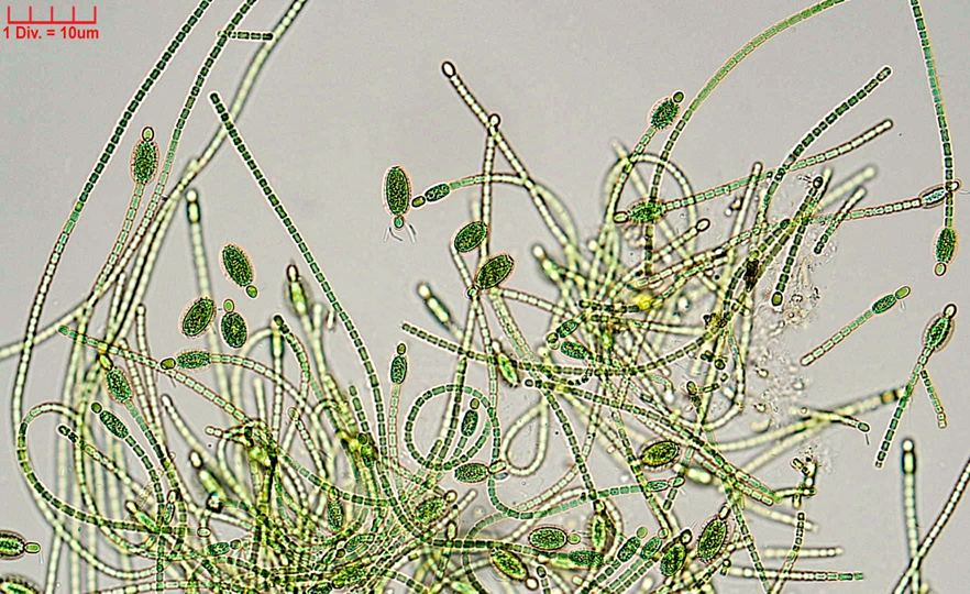./Cyanobacteria/Nostocales/Nostocaceae/Cylindrospermum/stagnale/cylindrospermum-stagnale-635.png