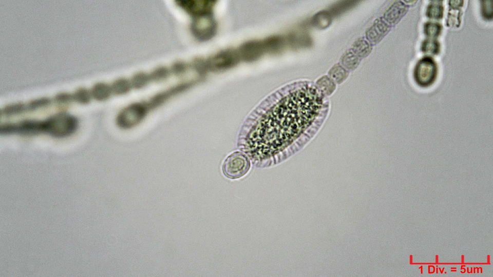 ./Cyanobacteria/Nostocales/Nostocaceae/Cylindrospermum/stagnale/cylindrospermum-stagnale-636.png