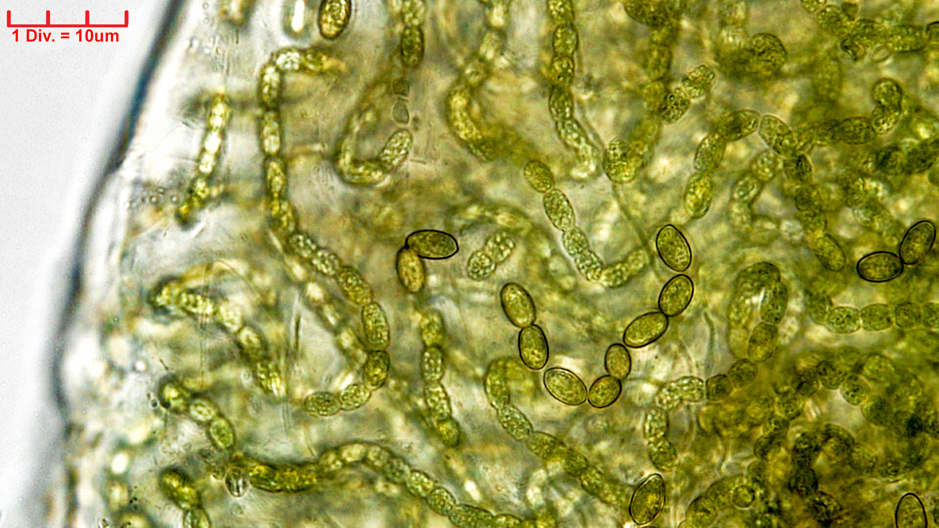 Cyanobacteria/Nostocales/Nostocaceae/Desmonostoc/muscorum/desmonostoc-muscorum-590.jpg
