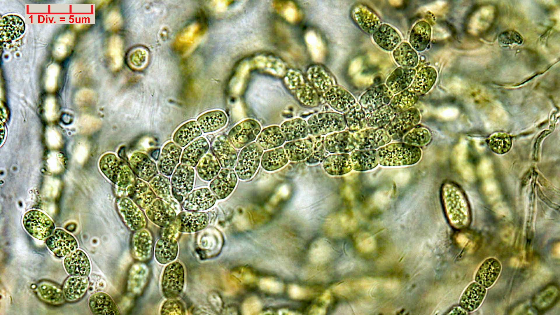 ././Cyanobacteria/Nostocales/Nostocaceae/Desmonostoc/muscorum/desmonostoc-muscorum-592.jpg