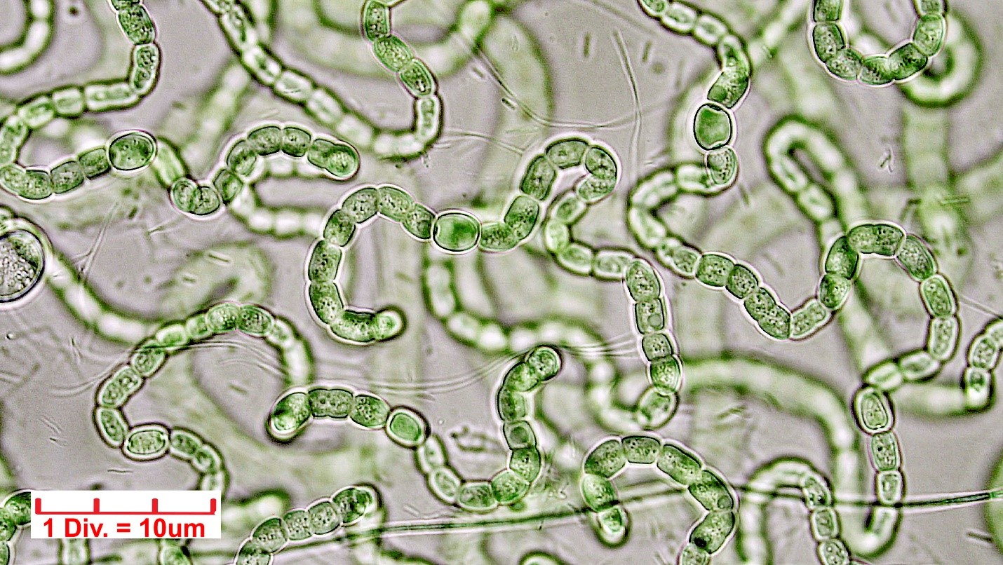 Cyanobacteria/Nostocales/Nostocaceae/Nostoc/carneum/nostoc-carneum-594.jpg