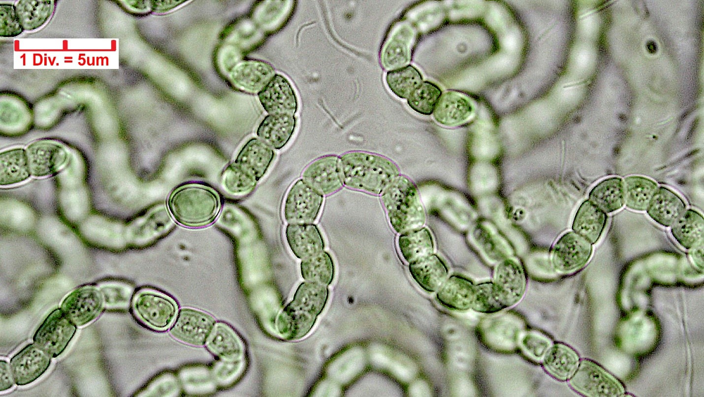 Cyanobacteria/Nostocales/Nostocaceae/Nostoc/carneum/nostoc-carneum-595.jpg
