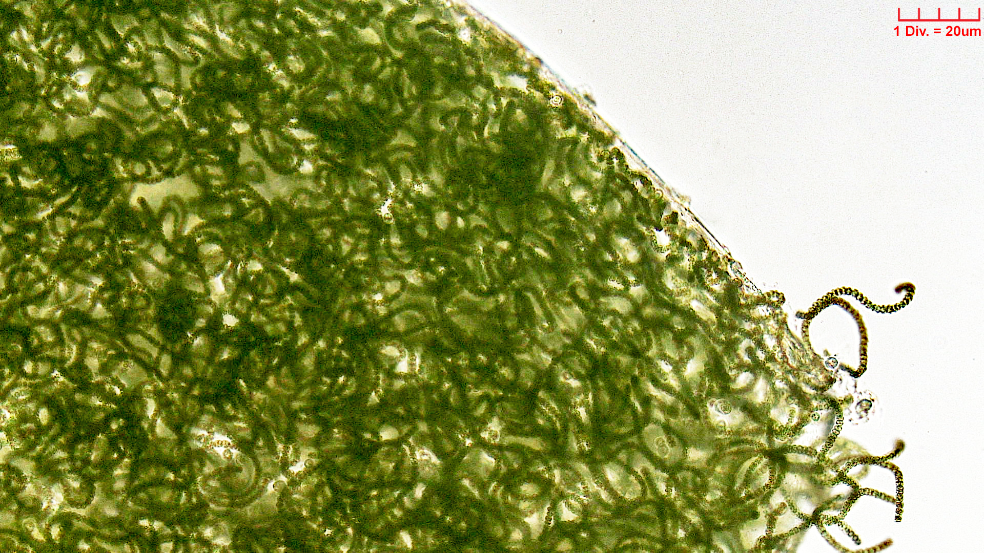 Cyanobacteria/Nostocales/Nostocaceae/Nostoc/kihlmanii/nostoc-kihlmanii-613.jpg