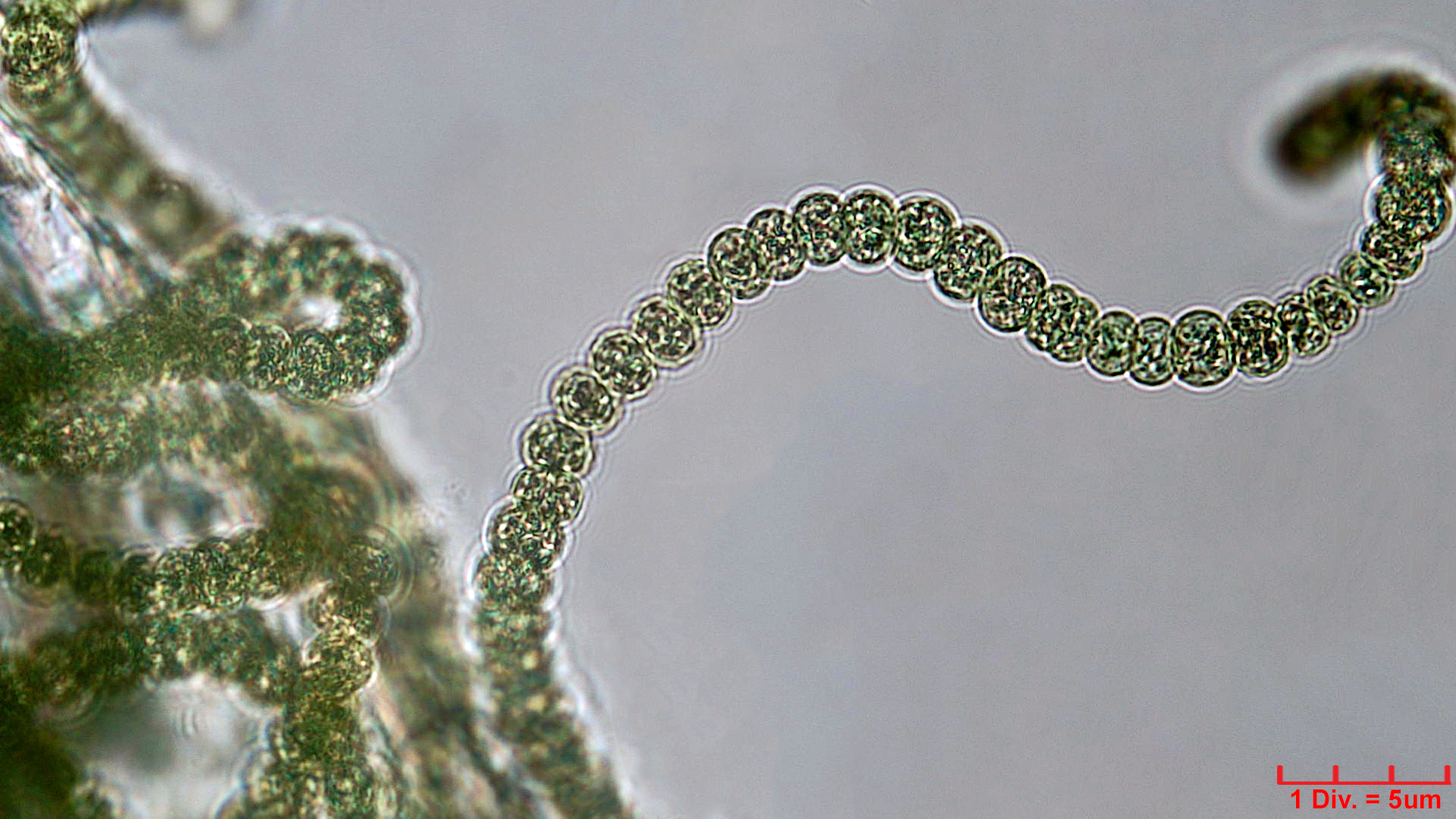Cyanobacteria/Nostocales/Nostocaceae/Nostoc/kihlmanii/nostoc-kihlmanii-615.jpg