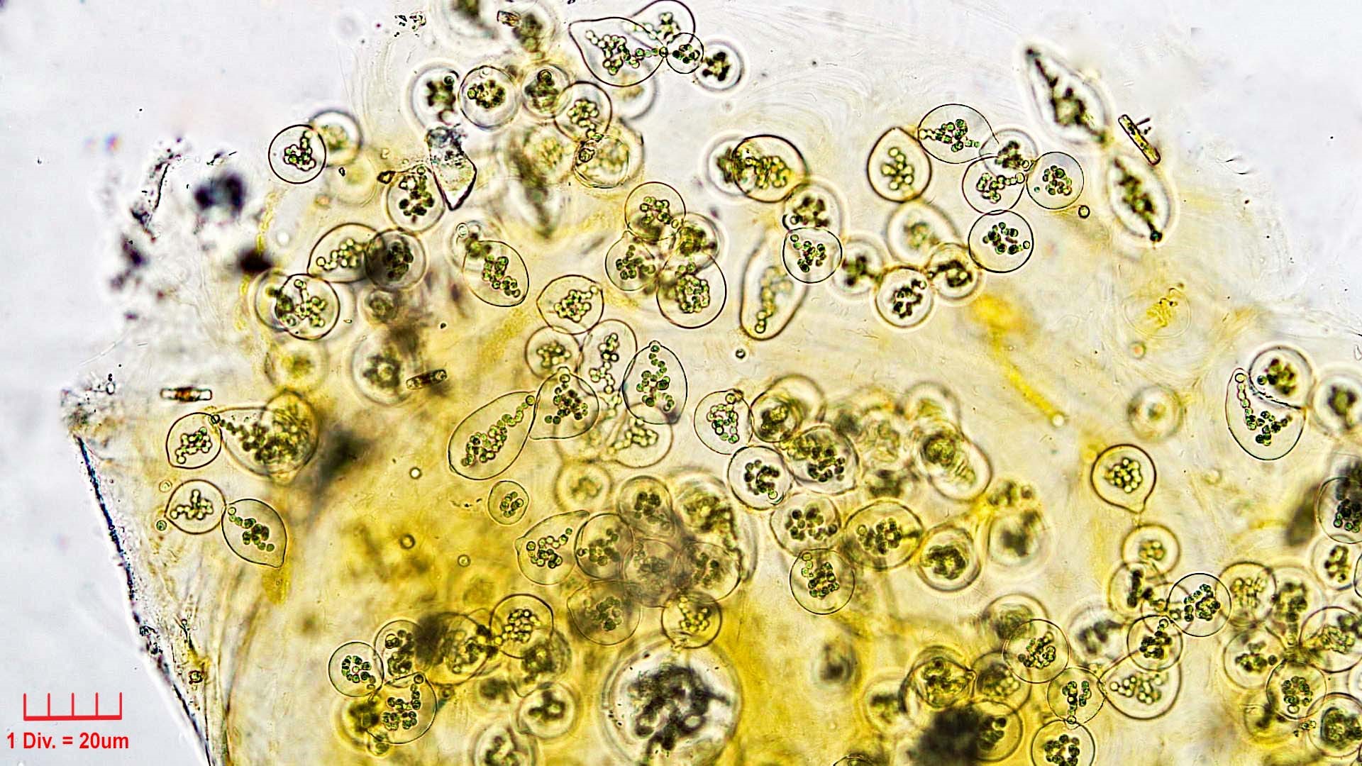 Cyanobacteria/Nostocales/Nostocaceae/Nostoc/microscopicum/nostoc-microscopicum-605.jpg