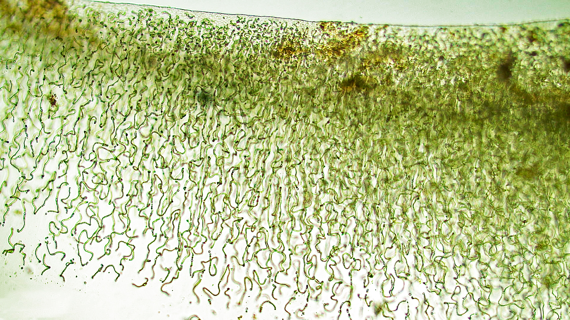 ./Cyanobacteria/Nostocales/Nostocaceae/Nostoc/pruniforme/nostoc-pruniforme-3.jpg