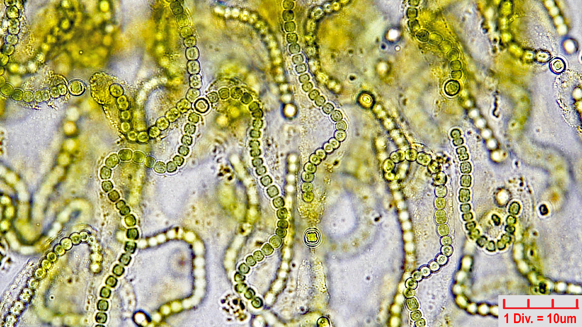 Cyanobacteria/Nostocales/Nostocaceae/Nostoc/pruniforme/nostoc-pruniforme-5.jpg