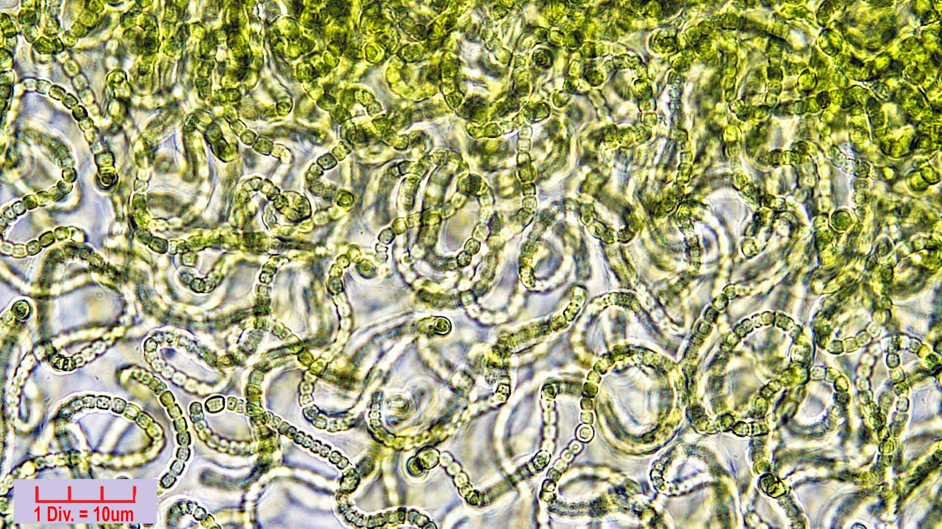 ./Cyanobacteria/Nostocales/Nostocaceae/Nostoc/verrucosum/nostoc-verrucosum-609.jpg