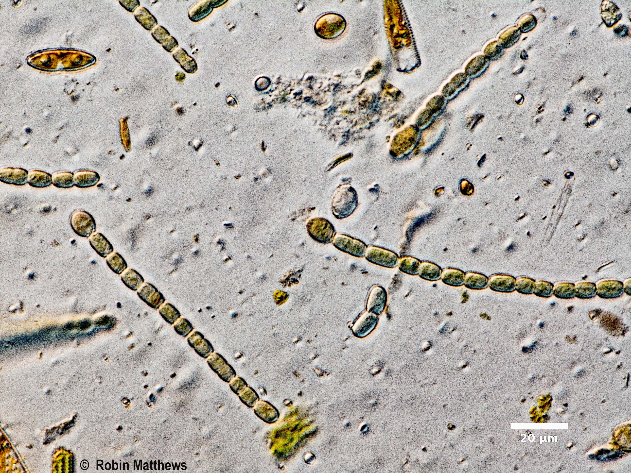 ./Cyanobacteria/Nostocales/Nostocaceae/Trichormus/azollae/trichormus-azollae-630.jpg