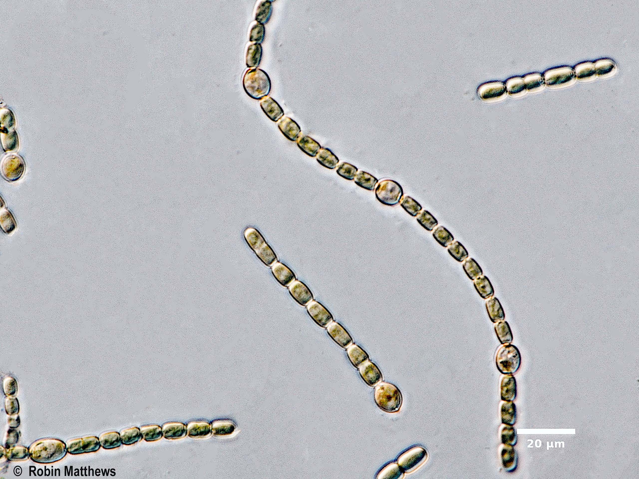 ./Cyanobacteria/Nostocales/Nostocaceae/Trichormus/azollae/trichormus-azollae-631.jpg