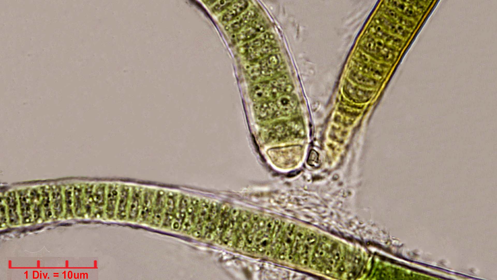 Cyanobacteria/Nostocales/Rivulariaceae/Calothrix/confervicola/calothrix-confervicola-445.jpg