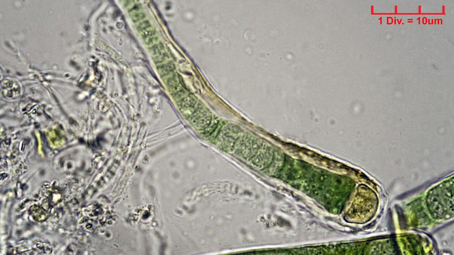 Cyanobacteria/Nostocales/Rivulariaceae/Calothrix/confervicola/calothrix-confervicola-446.jpg