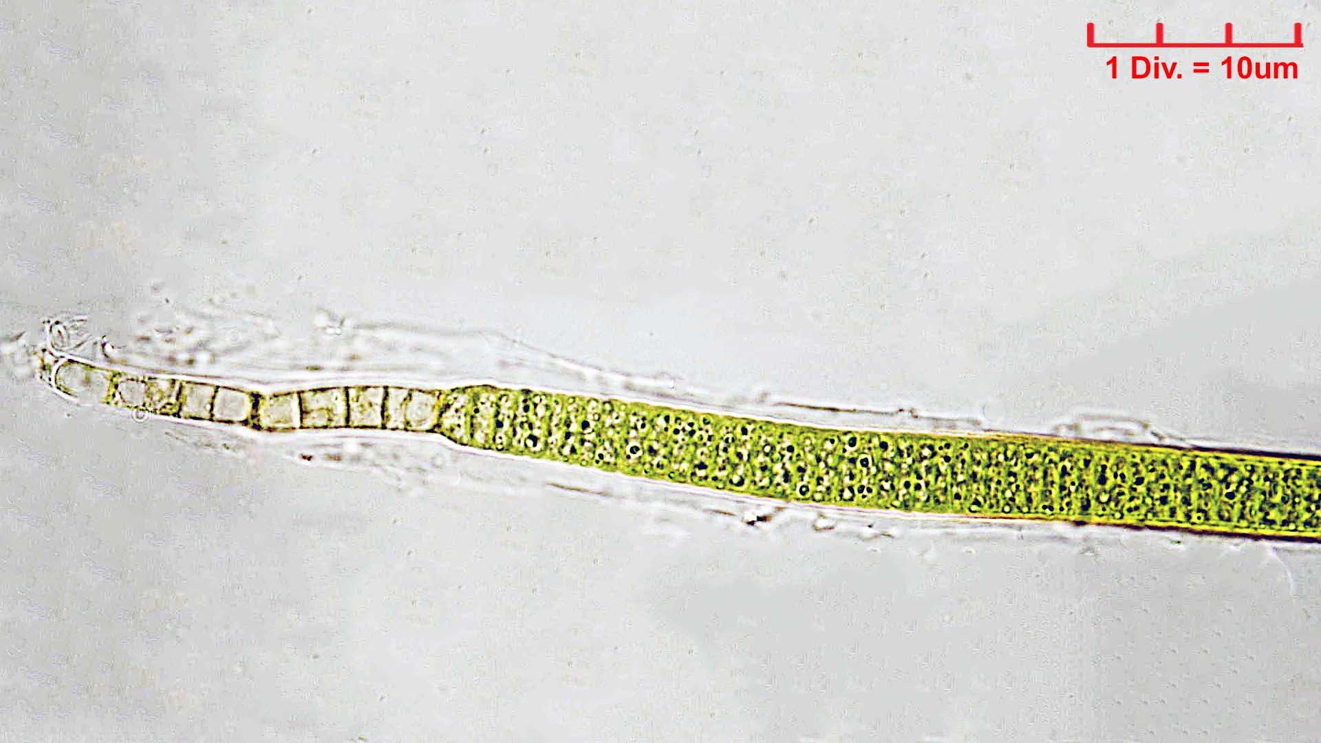 Cyanobacteria/Nostocales/Rivulariaceae/Calothrix/confervicola/calothrix-confervicola-449.jpg