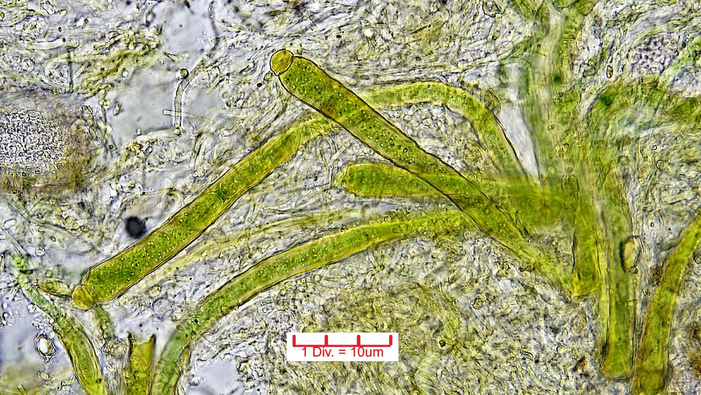 Cyanobacteria/Nostocales/Rivulariaceae/Calothrix/parietina/calothrix-parietina-438.jpg