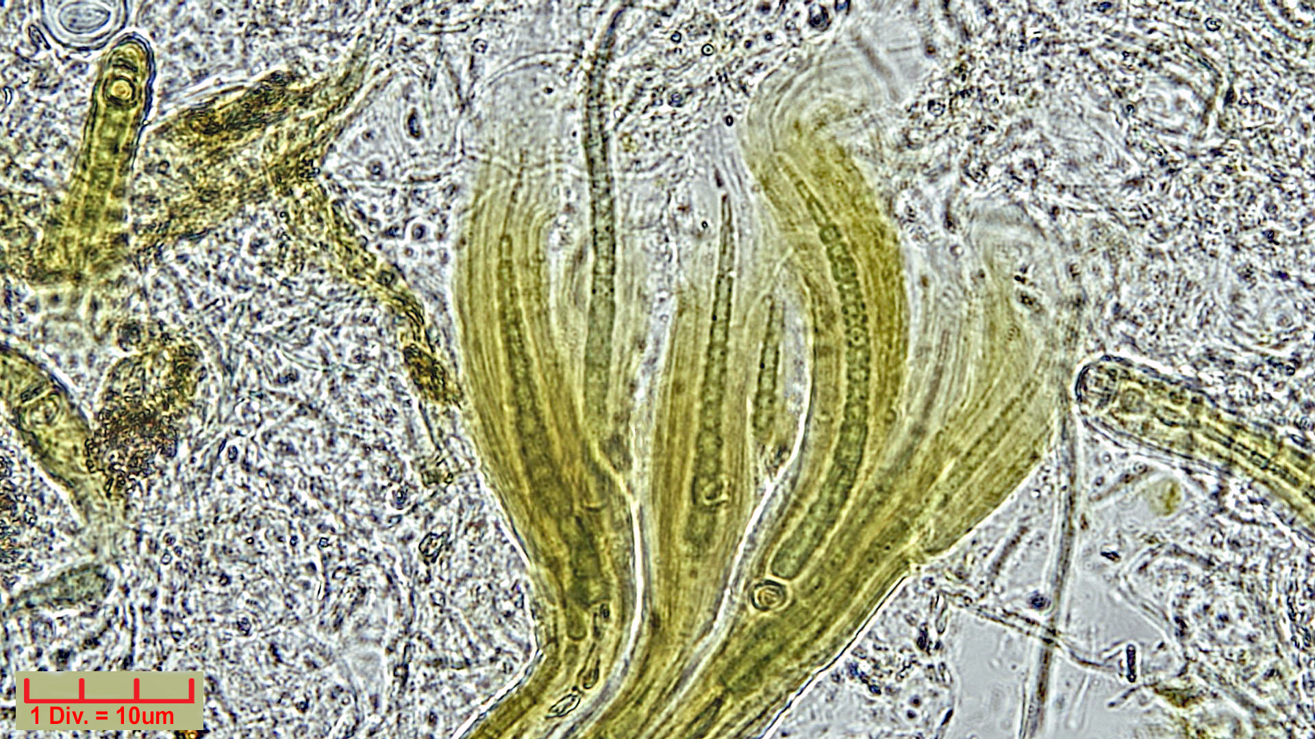 Cyanobacteria/Nostocales/Rivulariaceae/Dichothrix/gypsophila/dichothrix-gypsophila-458.jpg