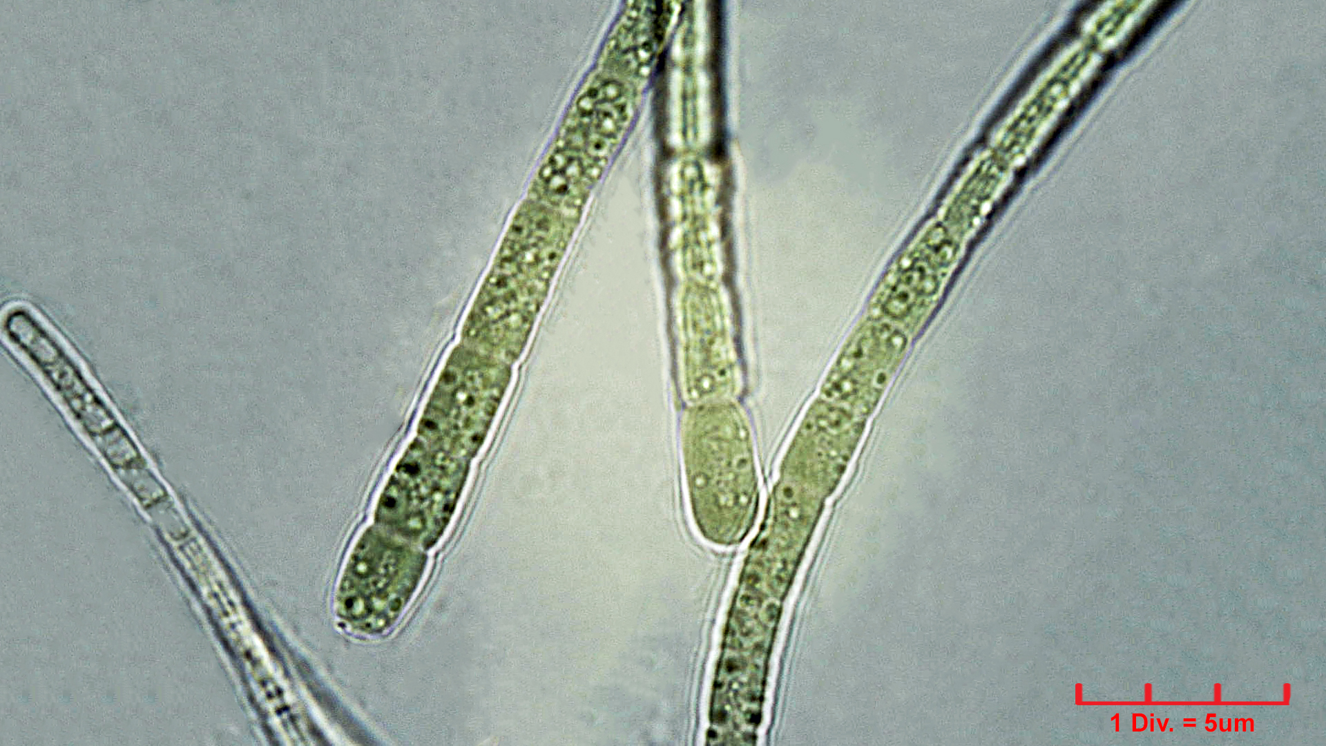Cyanobacteria/Nostocales/Rivulariaceae/Dichothrix/gypsophila/dichothrix-gypsophila-461.jpg