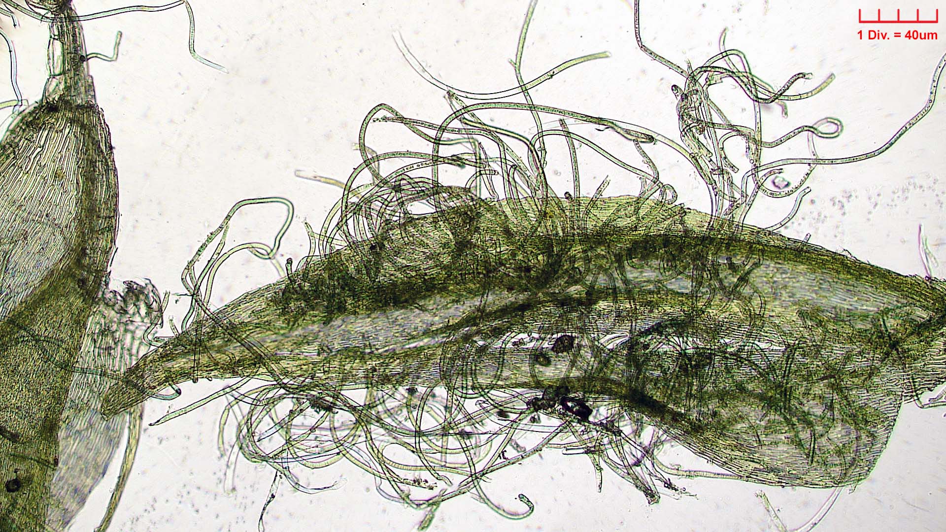 ././Cyanobacteria/Nostocales/Rivulariaceae/Microchaete/tenera/microchaete-tenera-476.jpg