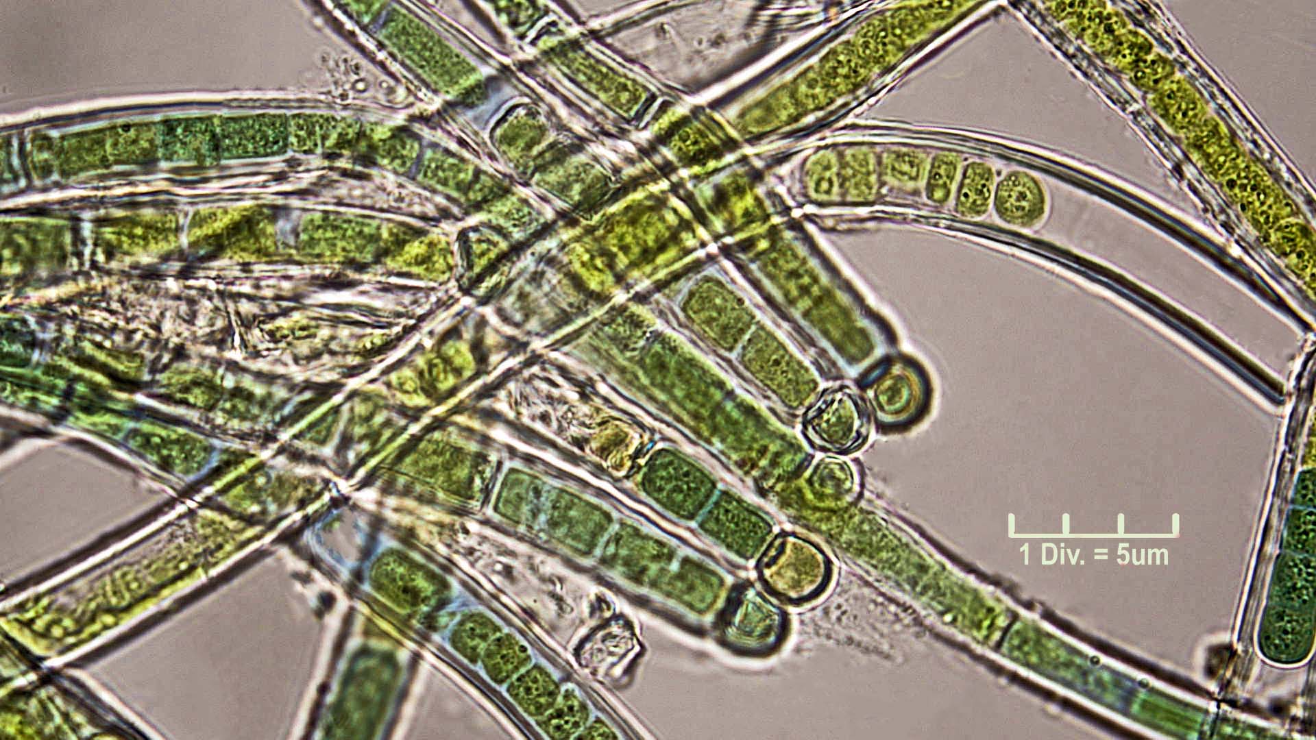 ./Cyanobacteria/Nostocales/Rivulariaceae/Microchaete/tenera/microchaete-tenera-479.jpg