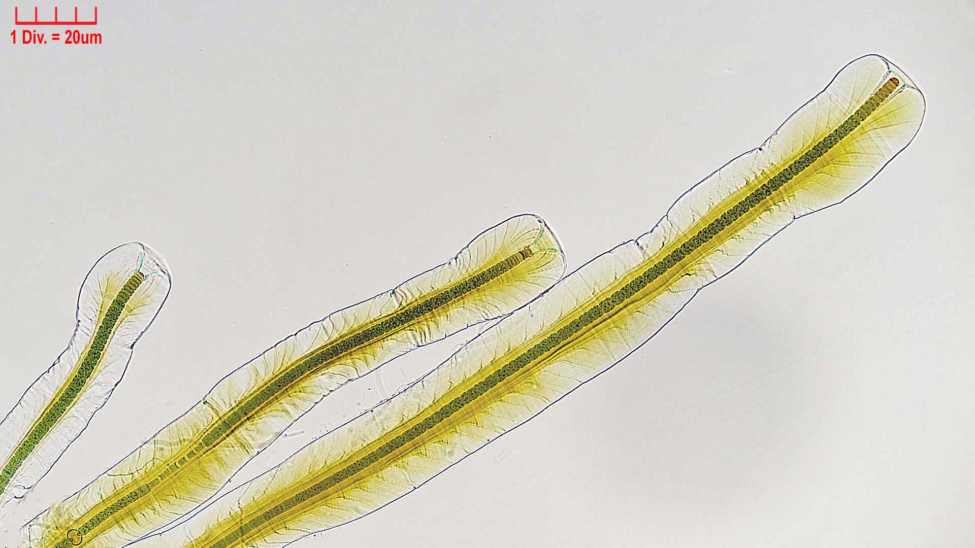 ./Cyanobacteria/Nostocales/Scytonemataceae/Petalonema/alatum/petalonema-alatum-406.jpg