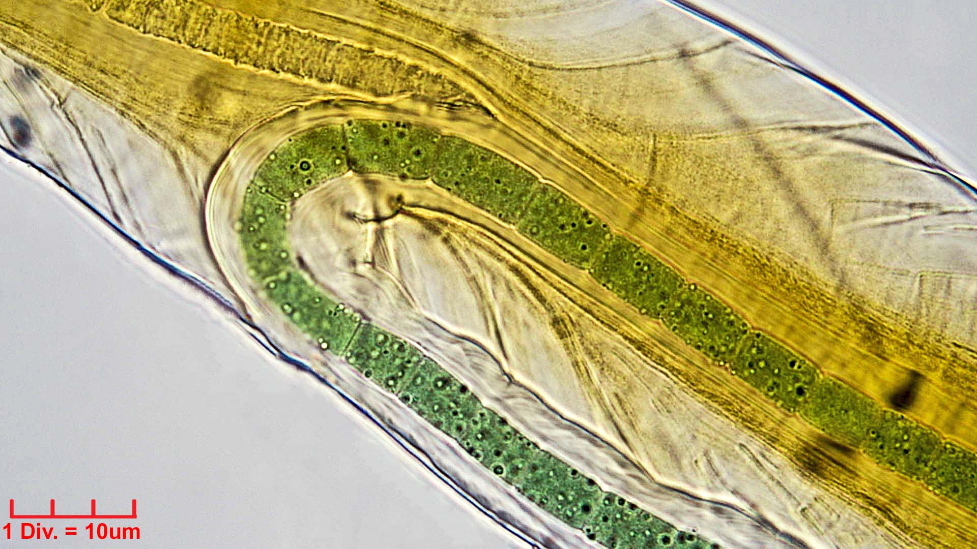 ./Cyanobacteria/Nostocales/Scytonemataceae/Petalonema/alatum/petalonema-alatum-408.jpg
