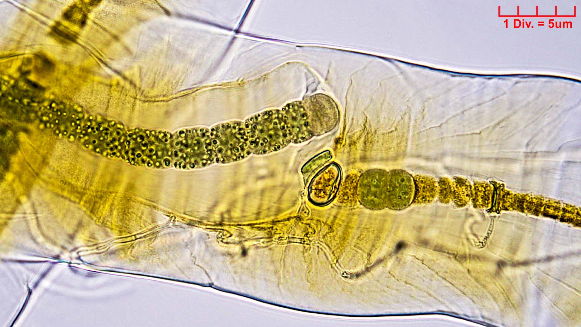 Cyanobacteria/Nostocales/Scytonemataceae/Petalonema/alatum/petalonema-alatum-409.jpg