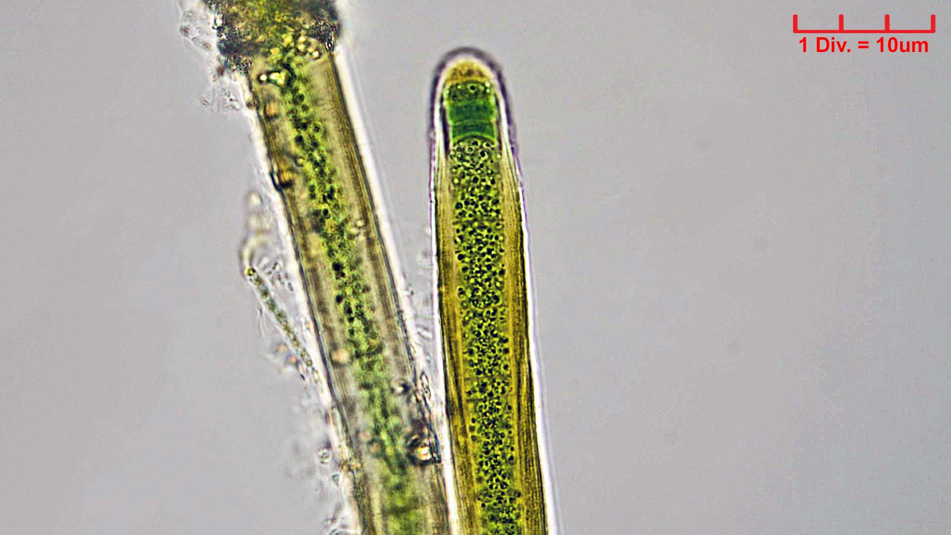 ././Cyanobacteria/Nostocales/Scytonemataceae/Petalonema/alatum/petalonema-alatum-411.jpg
