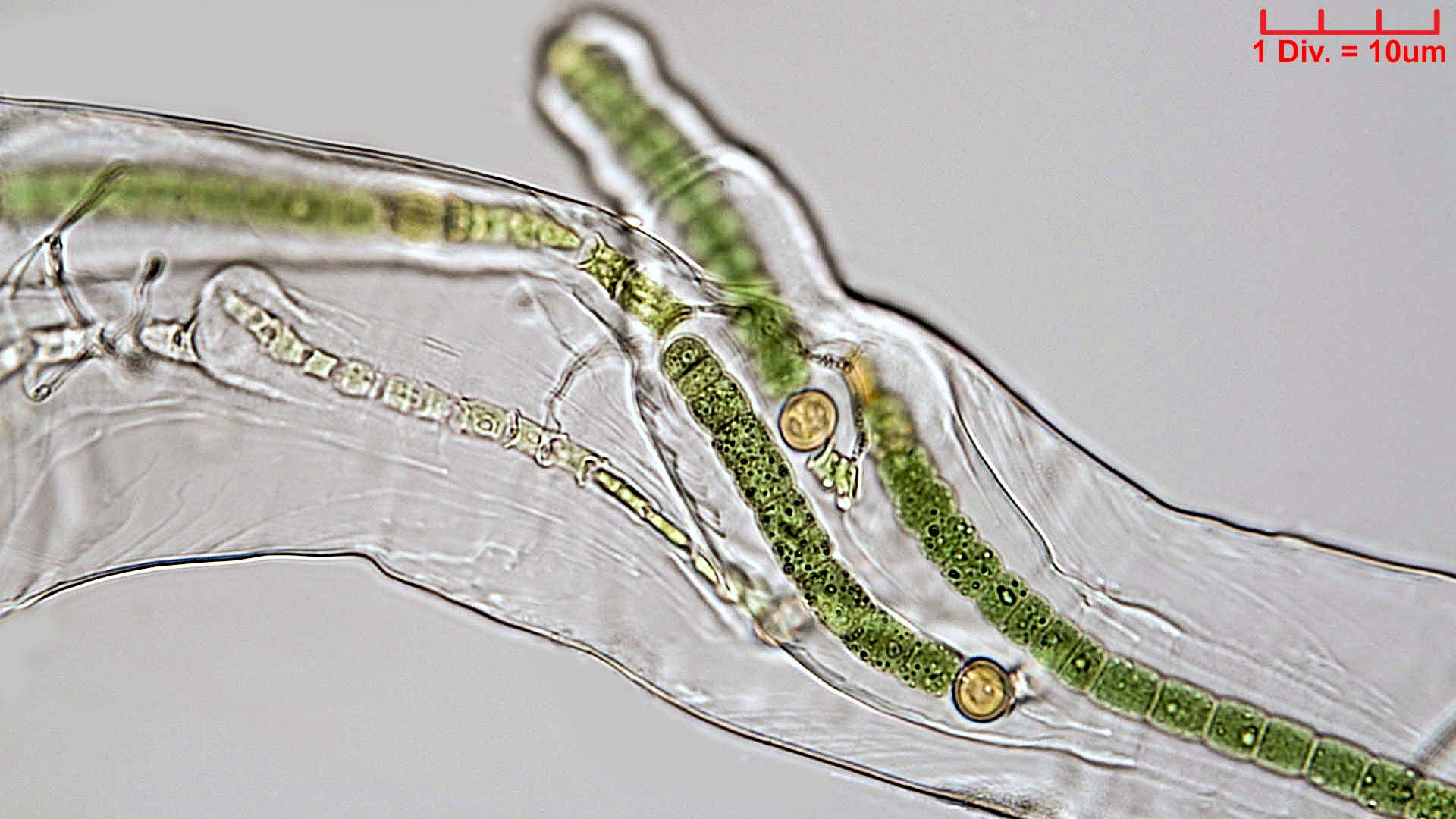 ./Cyanobacteria/Nostocales/Scytonemataceae/Petalonema/alatum/petalonema-alatum-412.jpg