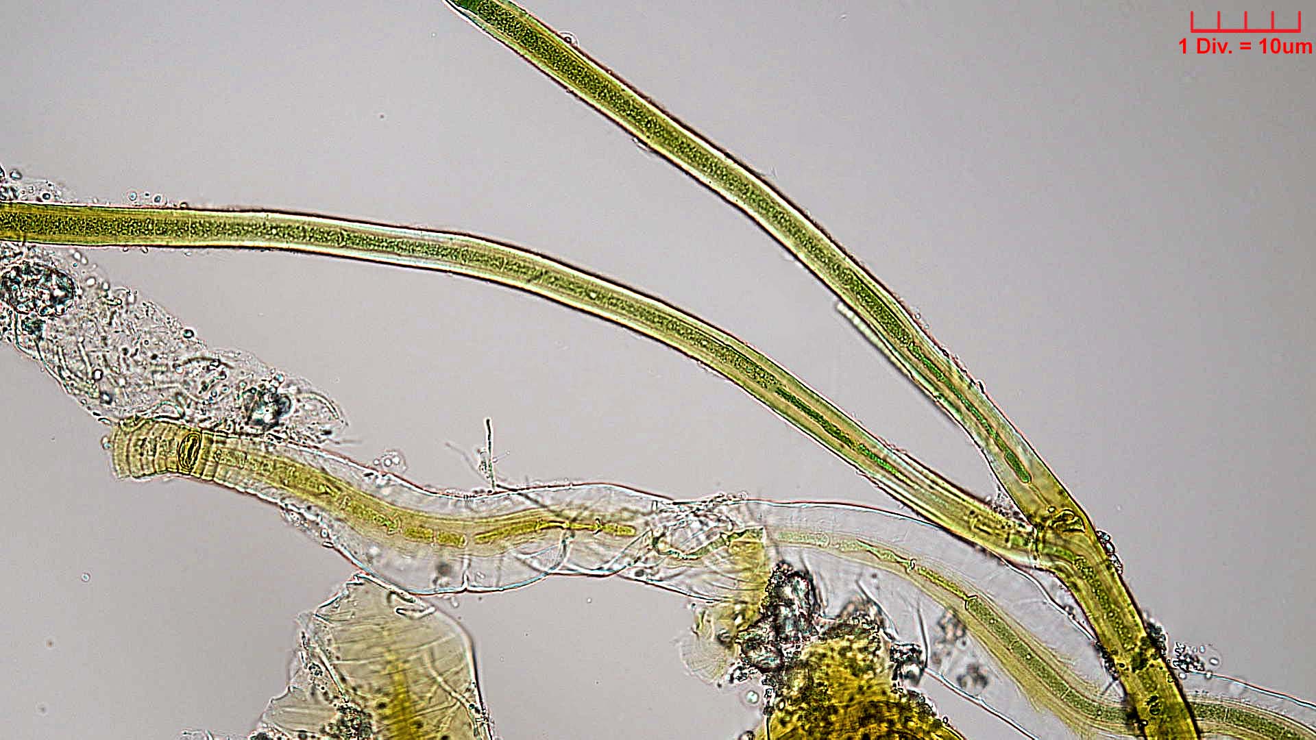 Cyanobacteria/Nostocales/Scytonemataceae/Petalonema/alatum/petalonema-alatum-413.jpg