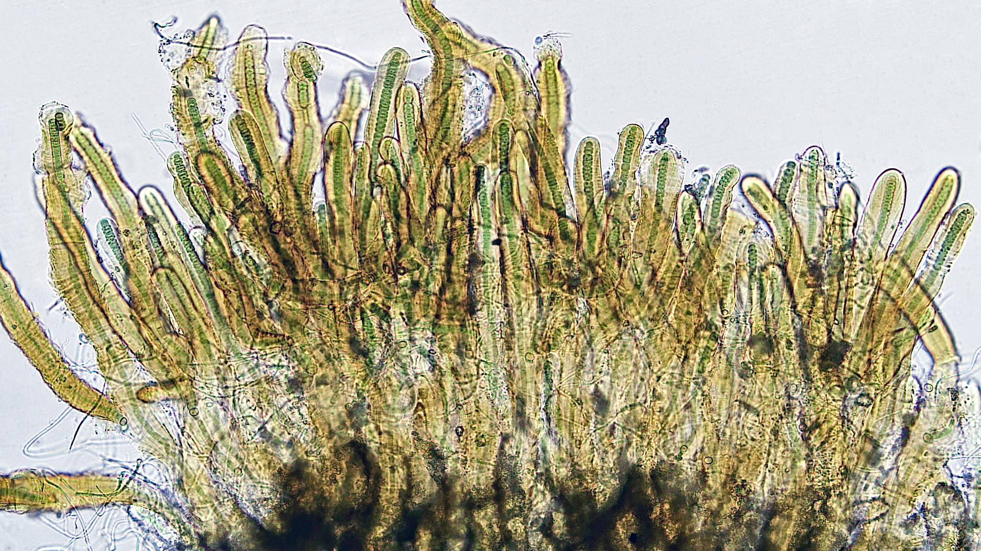 ./Cyanobacteria/Nostocales/Scytonemataceae/Petalonema/densum/petalonema-densum-1.jpg