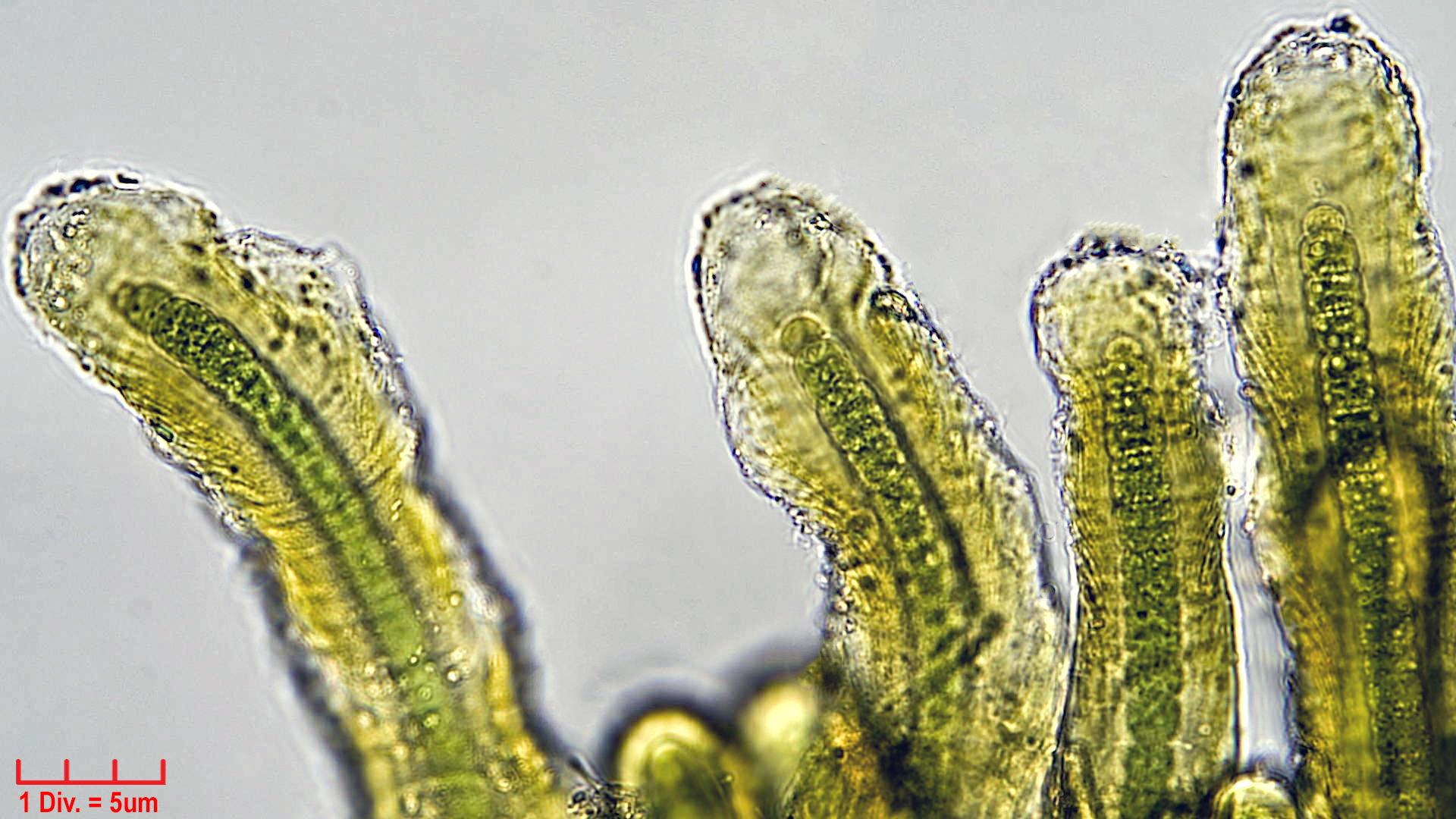 Cyanobacteria/Nostocales/Scytonemataceae/Petalonema/densum/petalonema-densum-2.jpg