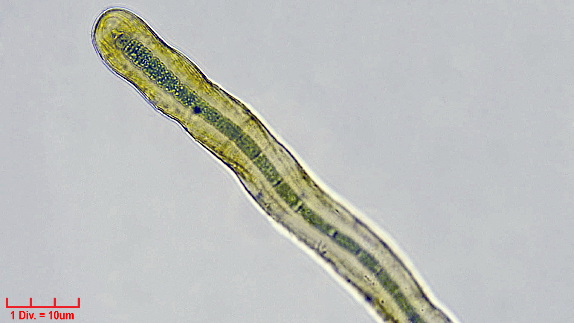./././Cyanobacteria/Nostocales/Scytonemataceae/Petalonema/densum/petalonema-densum-5.jpg