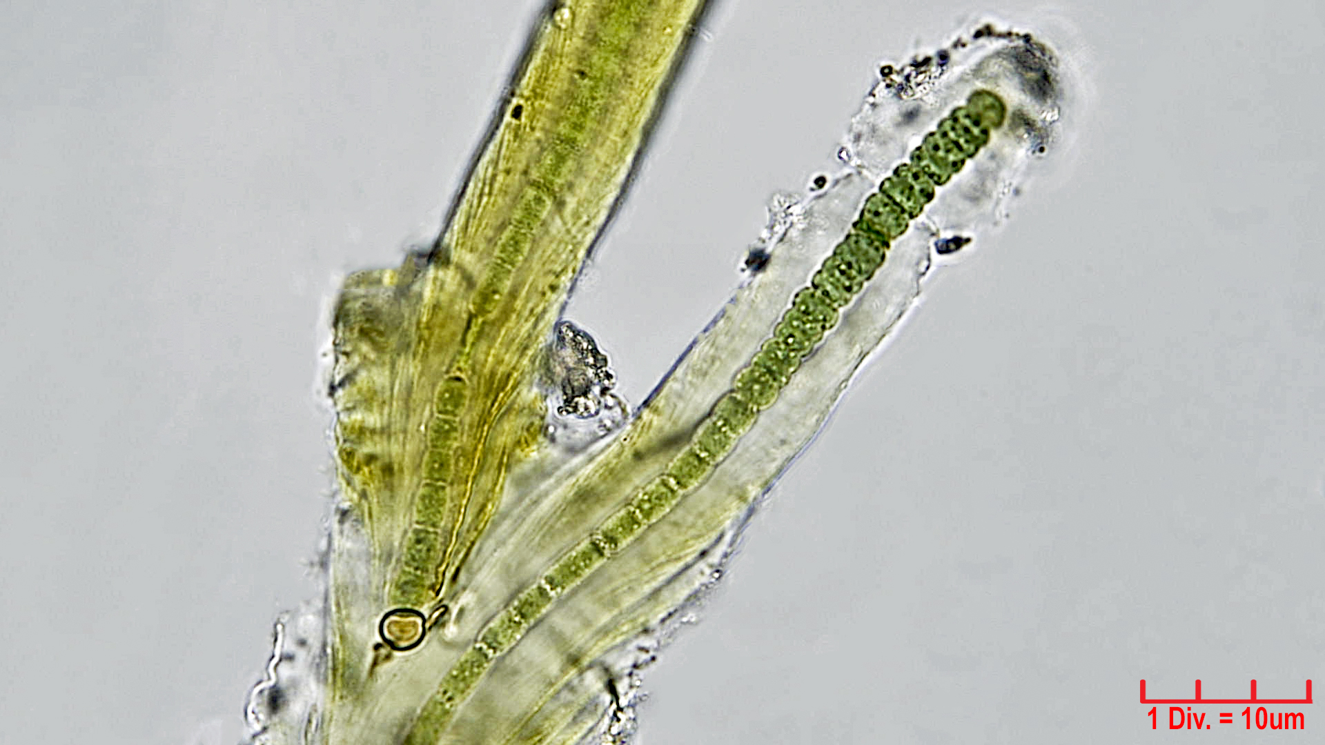 ./Cyanobacteria/Nostocales/Scytonemataceae/Petalonema/densum/petalonema-densum-7.jpg