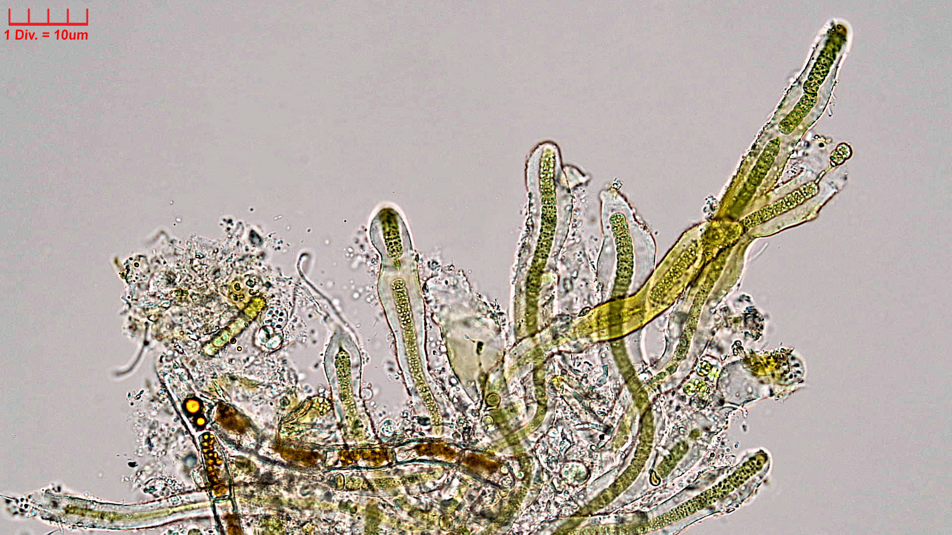 Cyanobacteria/Nostocales/Scytonemataceae/Petalonema/incrustans/petalonema-incrustans-414.jpg
