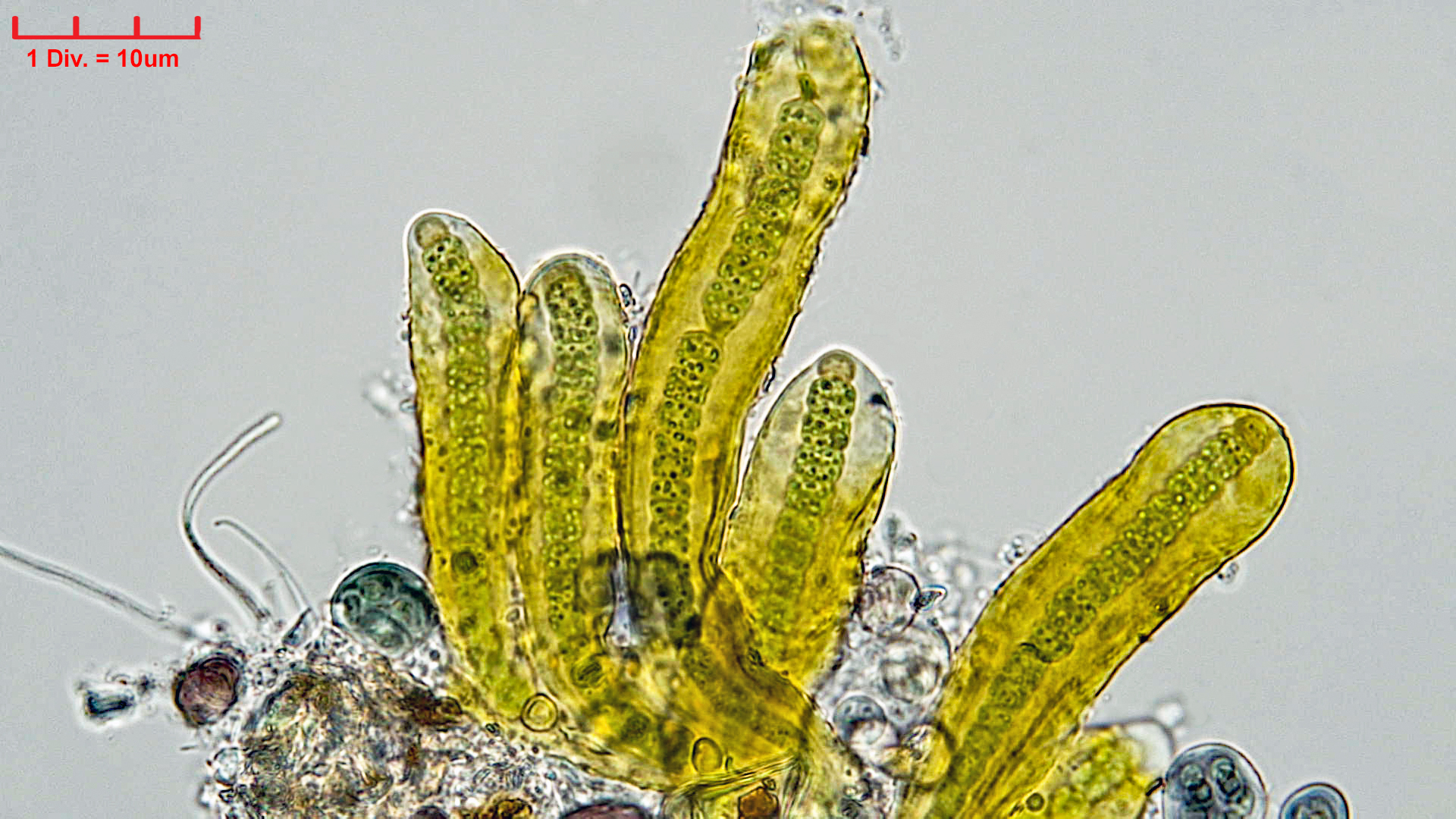 Cyanobacteria/Nostocales/Scytonemataceae/Petalonema/incrustans/petalonema-incrustans-415.jpg