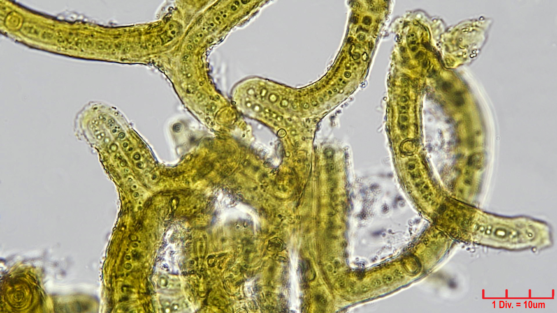 ././Cyanobacteria/Nostocales/Scytonemataceae/Petalonema/incrustans/petalonema-incrustans-417.jpg